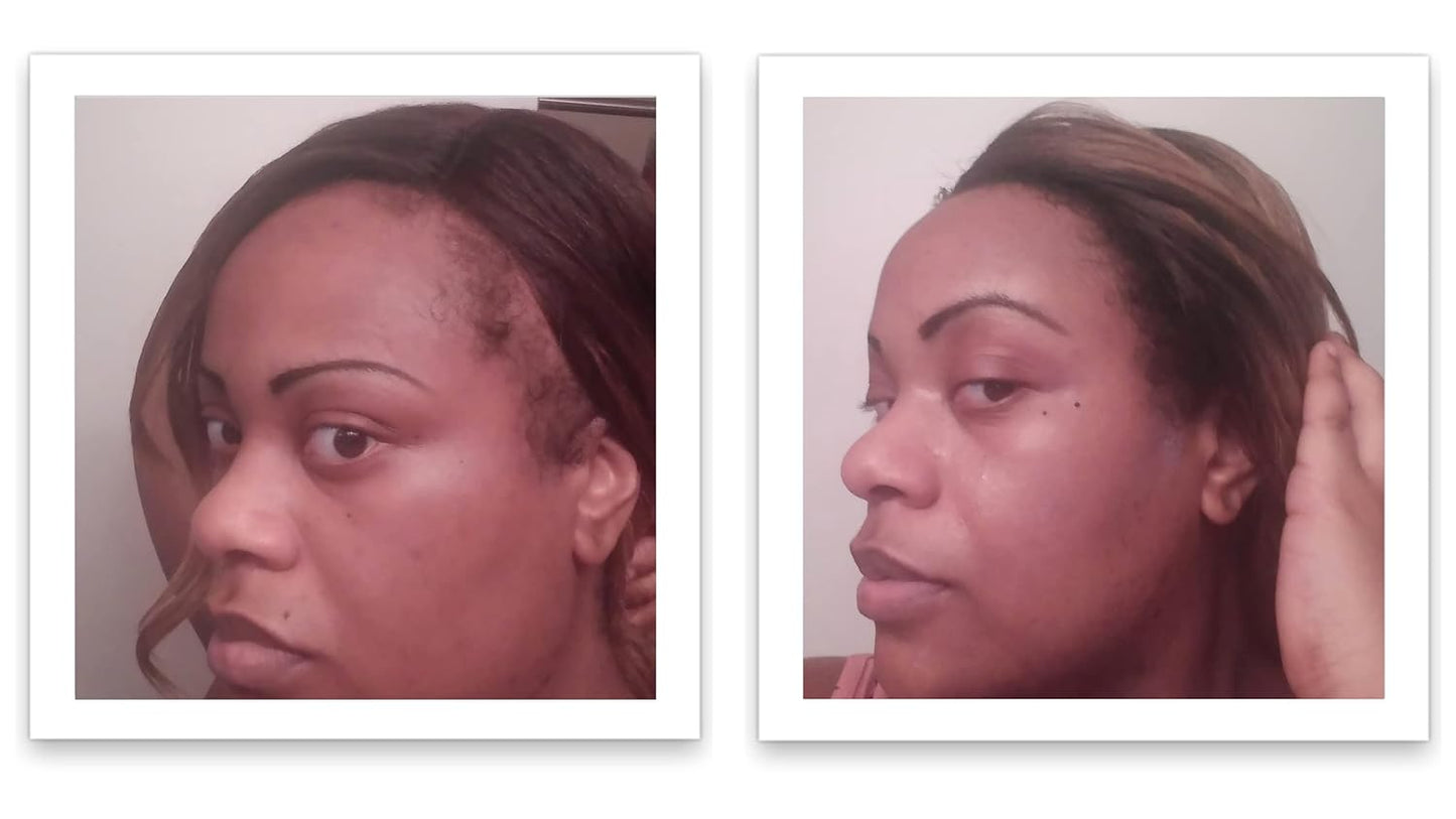 Caboki Hair Loss Concealer, All-Natural Hair Building Fiber. Make Thin Hair Look 10X Fuller Instantly. Eliminate the Appearance of Bald Spot and Thinning Hair (30G, 90-Day Supply). Black