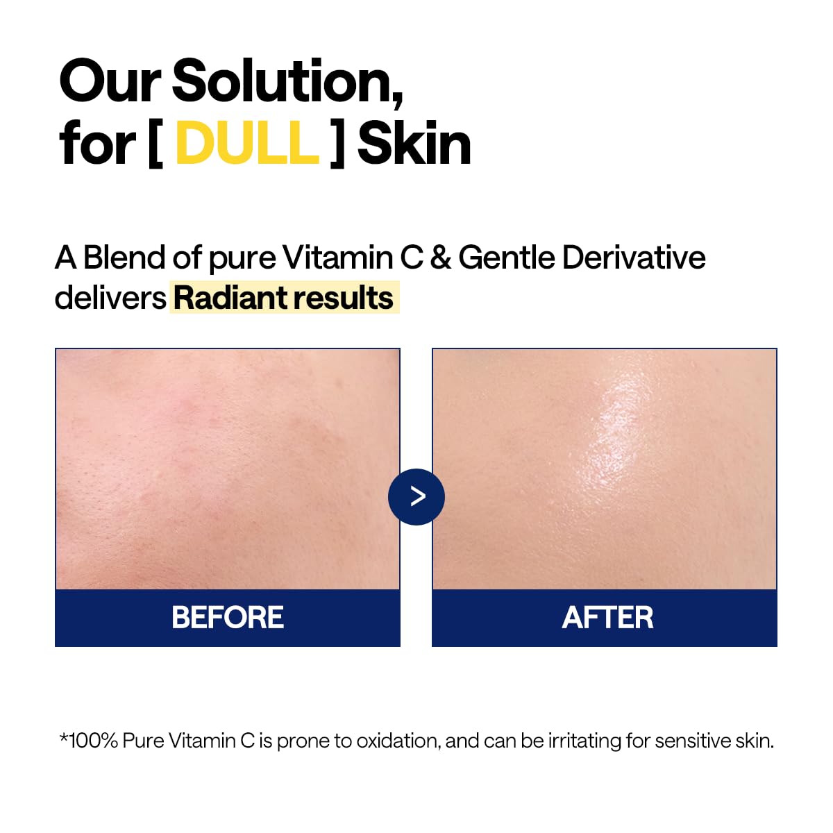 MEDIHEAL Vitamin C Brightening Serum for Radiant Skin (1.35 fl oz)