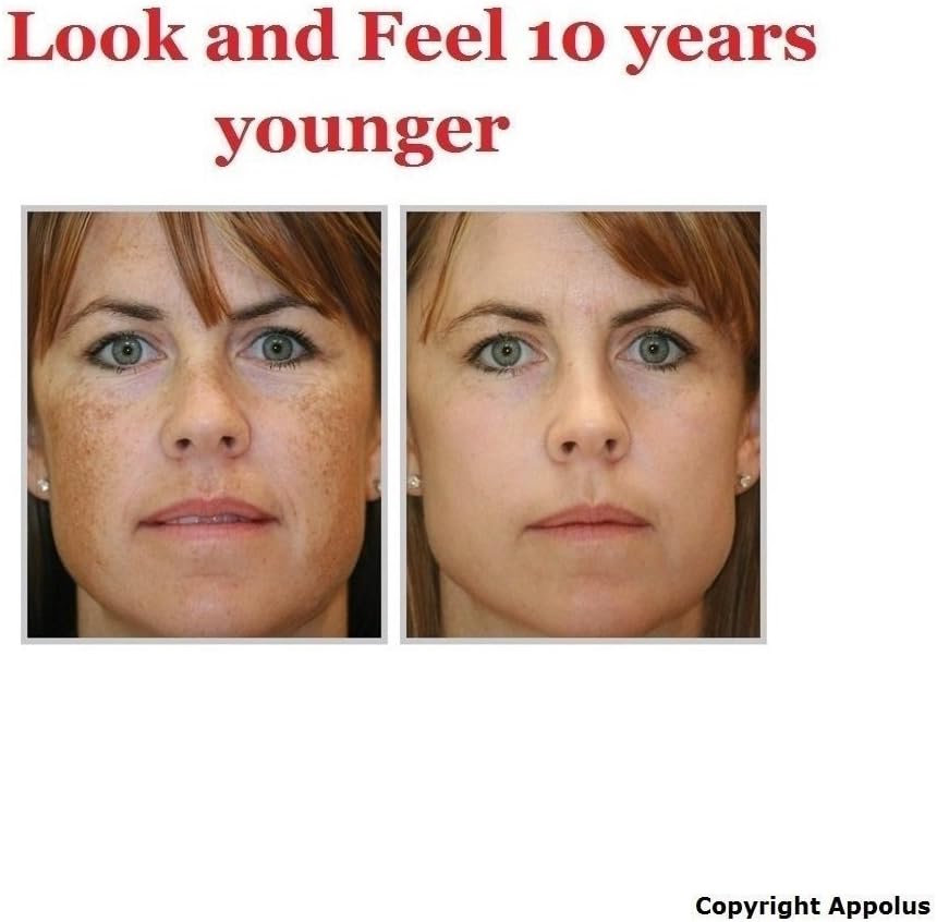 Microdermabrasion Machine - Appolus Premium Diamond Microdermabrasion Device Tool - 2 Diamond Tips - 5 Heads - Blackhead Blemishes Remover - Pores Fine Lines Minimizer