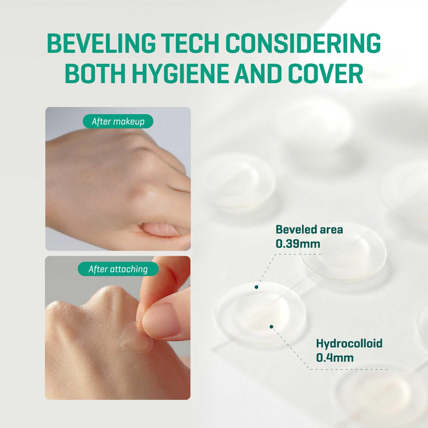 SOME BY MI 30 Days Miracle Clear Spot Patch - Pack of 1, 18 Counts, 2 Size(10mm 9Counts, 12mm
