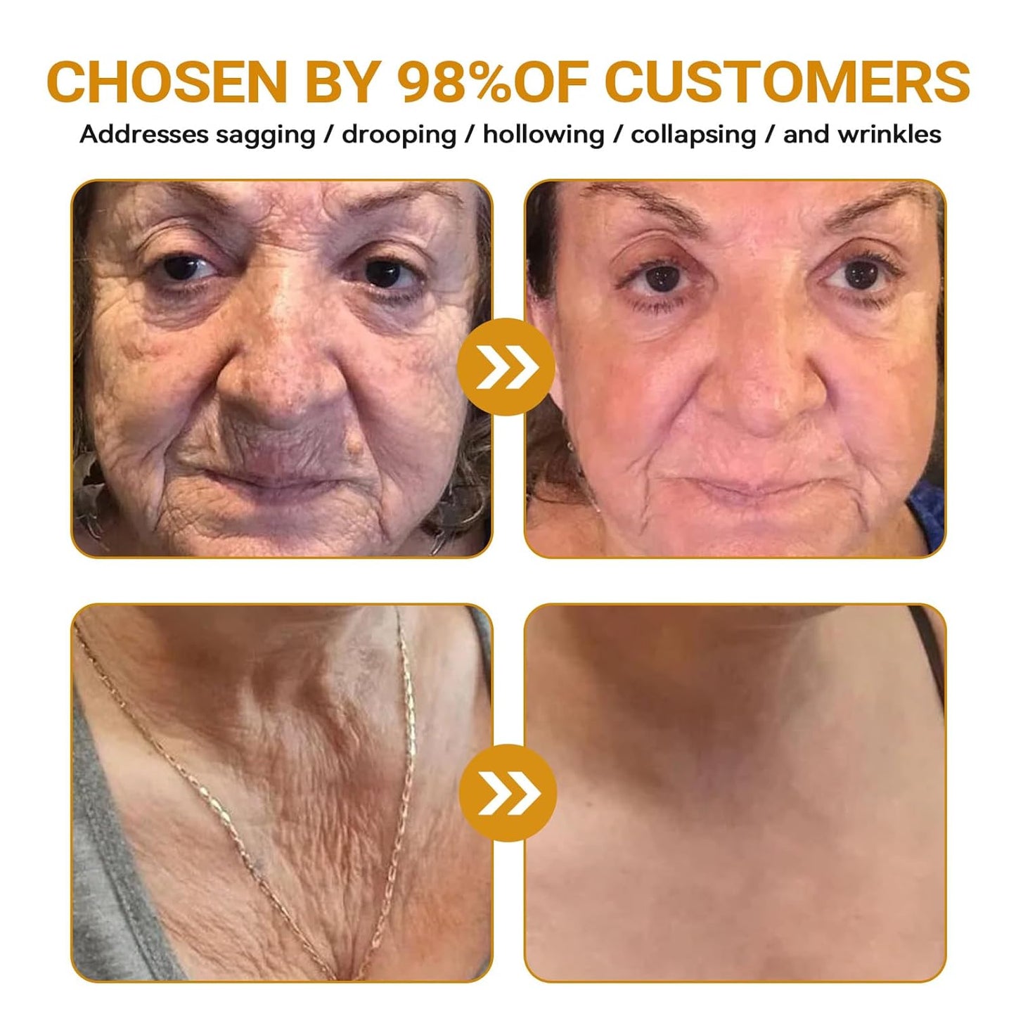 Bee Venom Skin Restoration Cream, Bee Venom Skin Treatment Cream, Repair skin and Firming, Effective In Reducing Blemishes (4)