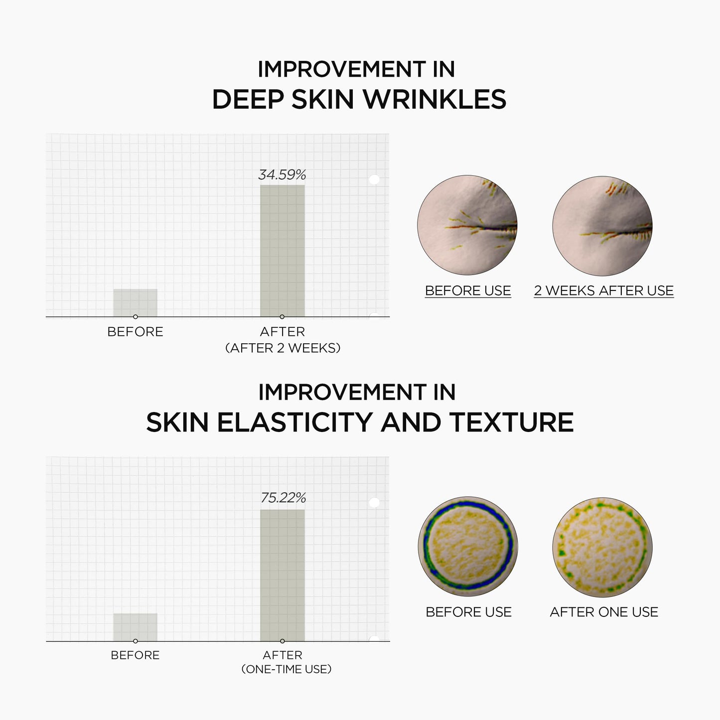 SKIN1004 Retinol 0.2% Boosting Shot Ampoule, Face Serum for Skin Elasticity, Facial Spicule Serum