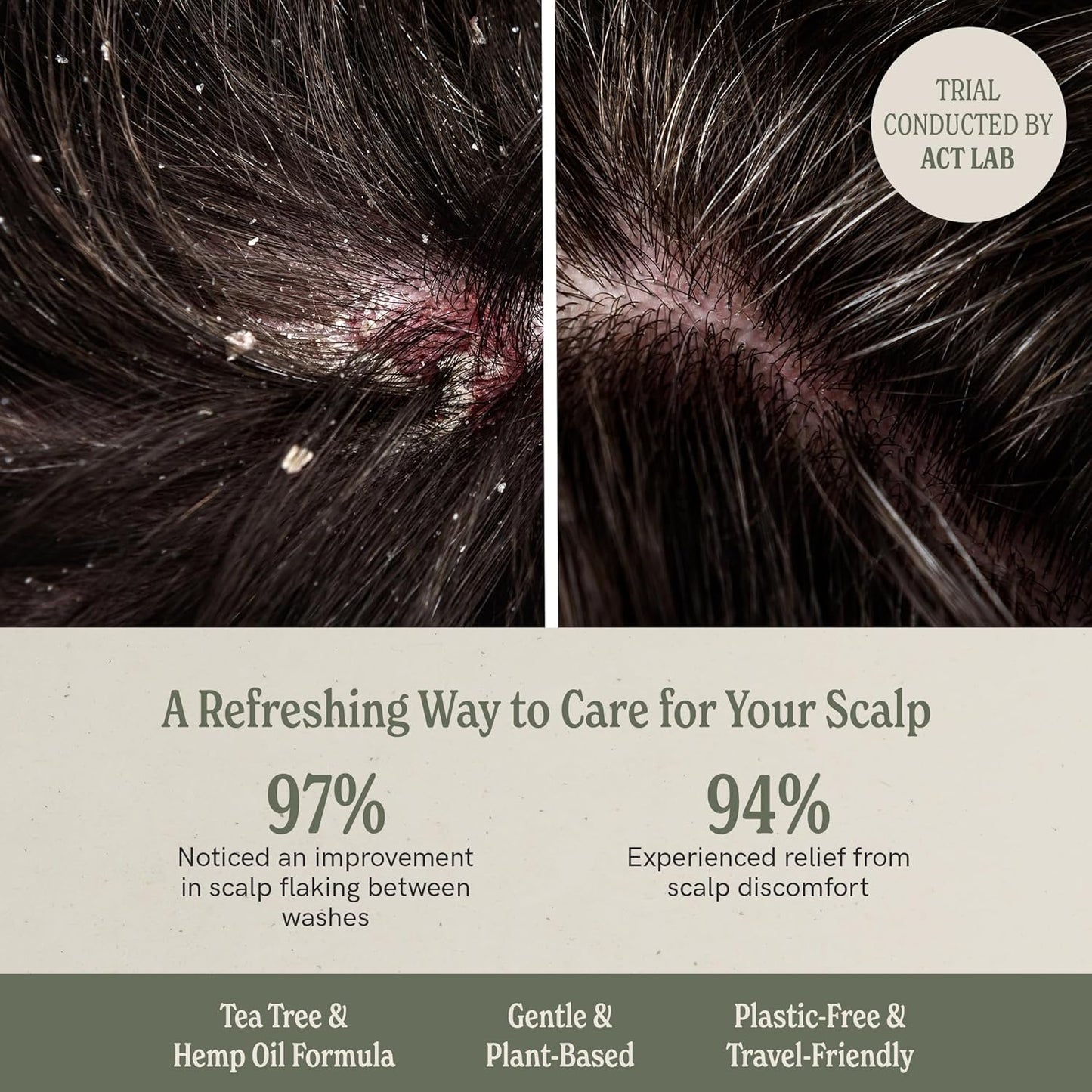 J·R·LIGGETT'S Shampoo Bar - Tea Tree Formula, All Natural Solid Shampoo Bar for Hair with Coconut Oil & Almond Oil, Sulfate Free, GMO Free, Fragrance-Free, Managing Scalp Conditions, 3.5 oz - 3 Pack