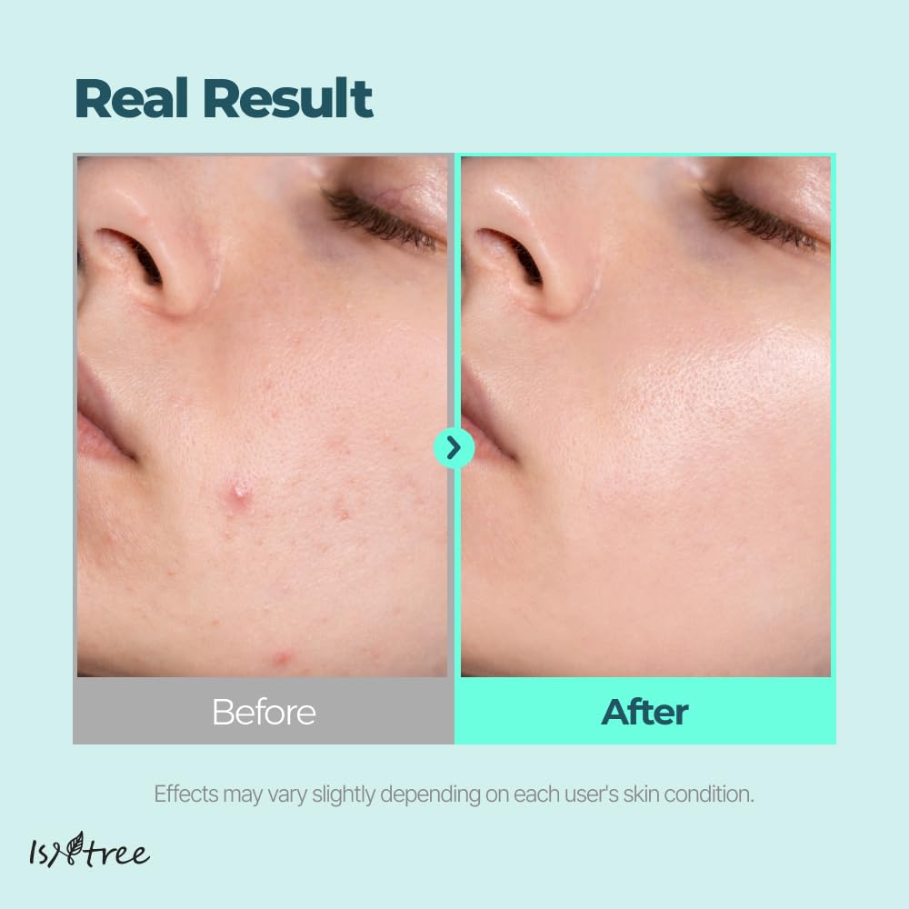 IsNtree Gim PDRN Deep Sleep Mask 80ml, 2.7 fl oz | Korean SEAWEED Skincare Sleeping Mask gel |