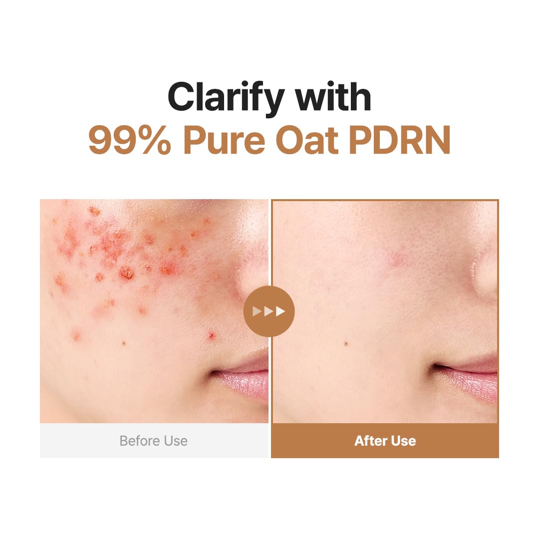 PURITO Oat PDRN Refining Toner | Exfoliating Acne Skin Facial Toner
