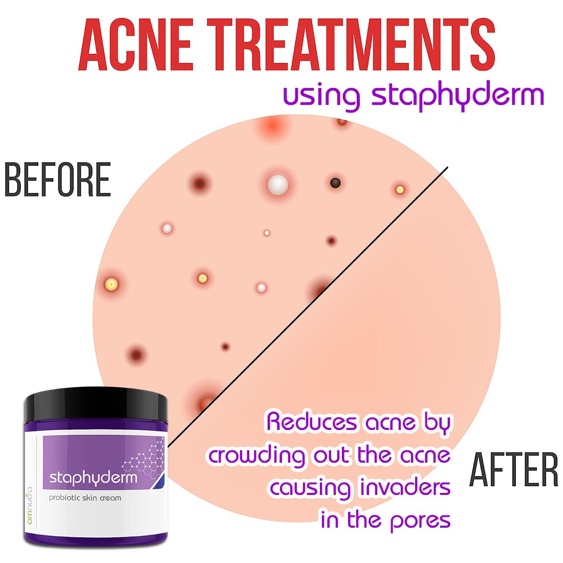 Staphyderm Non Antibiotic Ointment - All Natural Topical Probiotic Lotion New Skin Therapy Cream For Dry Itchy Skin Organic Based Topical Probiotics for Skin Care (8oz Cream)