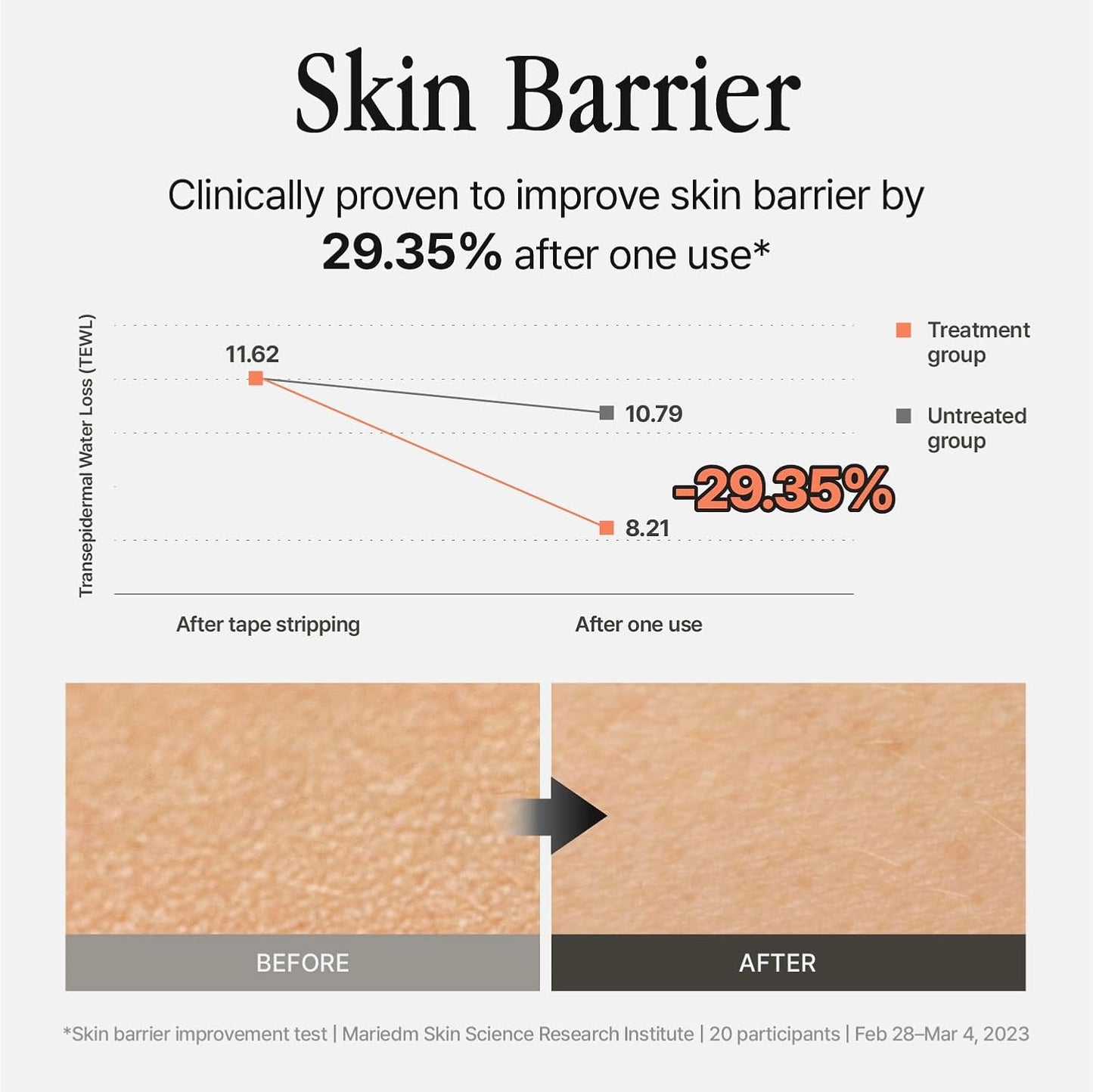 Silver Frost Mist - Facial Barrier Toner Spray with 80% Witch Hazel Water, Cica for Skin Barrier Repair, Recovery Mist for Sensitive Skin, Dewy Hydration, Korean Skin Care (3.38 fl oz)