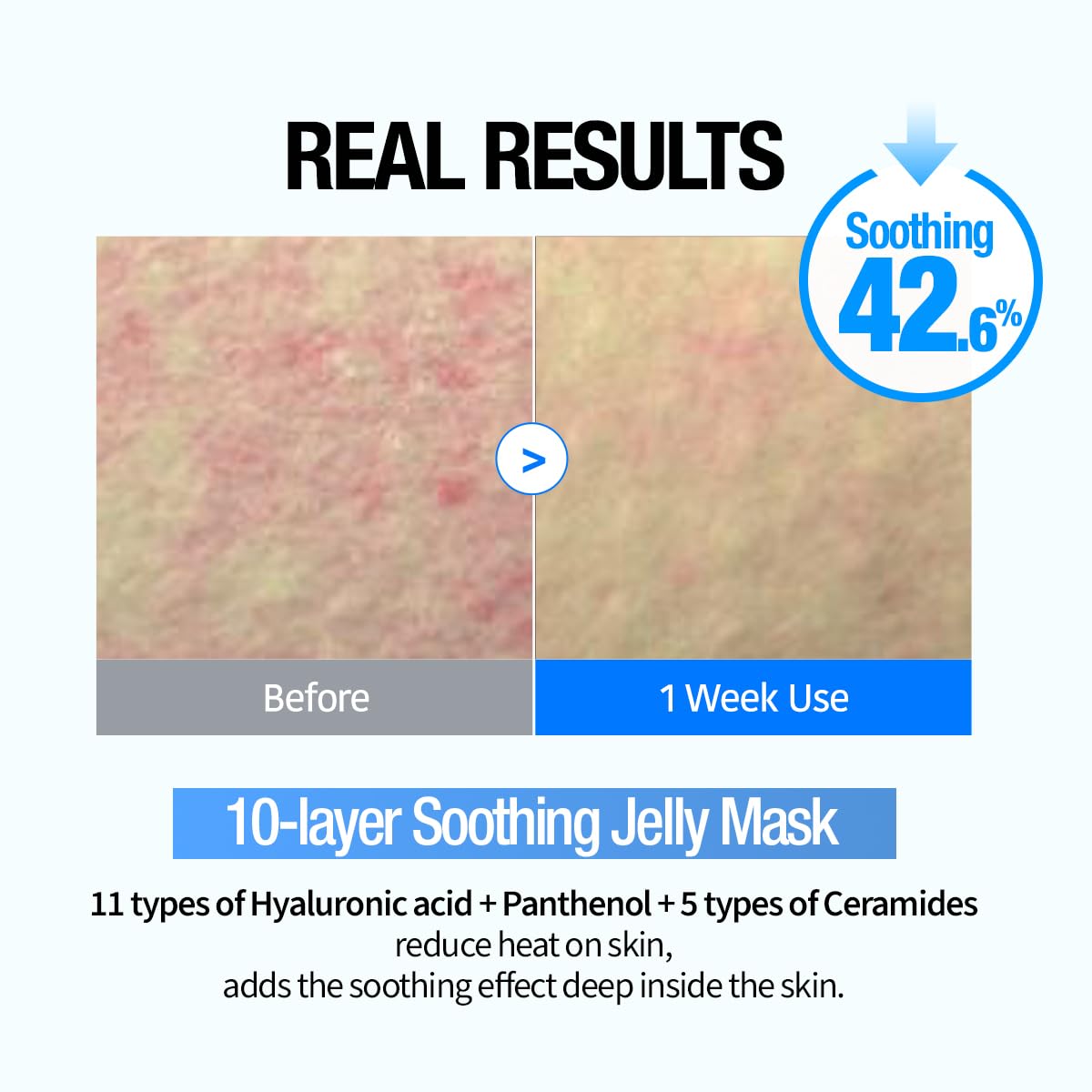 GOODAL Heartleaf Hyaluron Soothing Jelly Mask [1EA]
