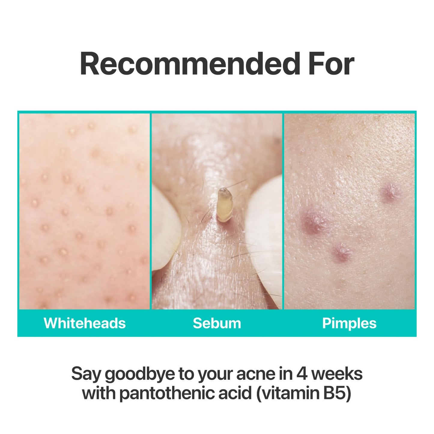 numbuzin No.1 Pantothenic B5 Active Soothing Cream | Remove sebum and skin troubles, Pantothenic
