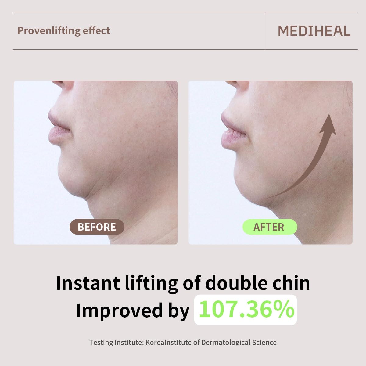 MEDIHEAL Retinol Collagen Cream Lifting Mask (4 Counts)