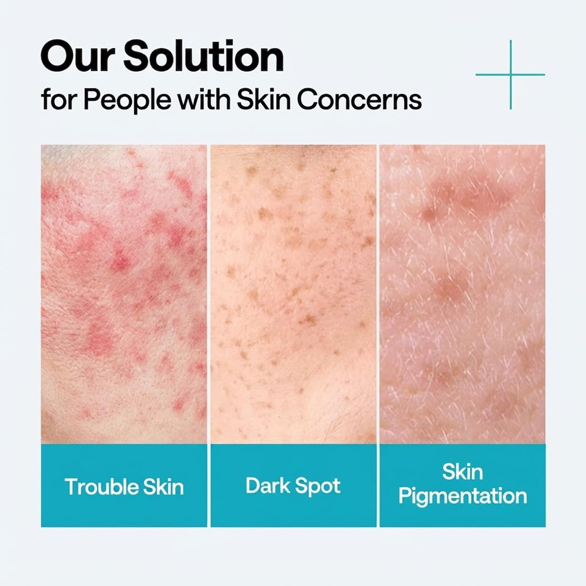 MEDIHEAL Madecassoside Repair Serum, Blemish Care & Hydration (1.35 fl.oz)