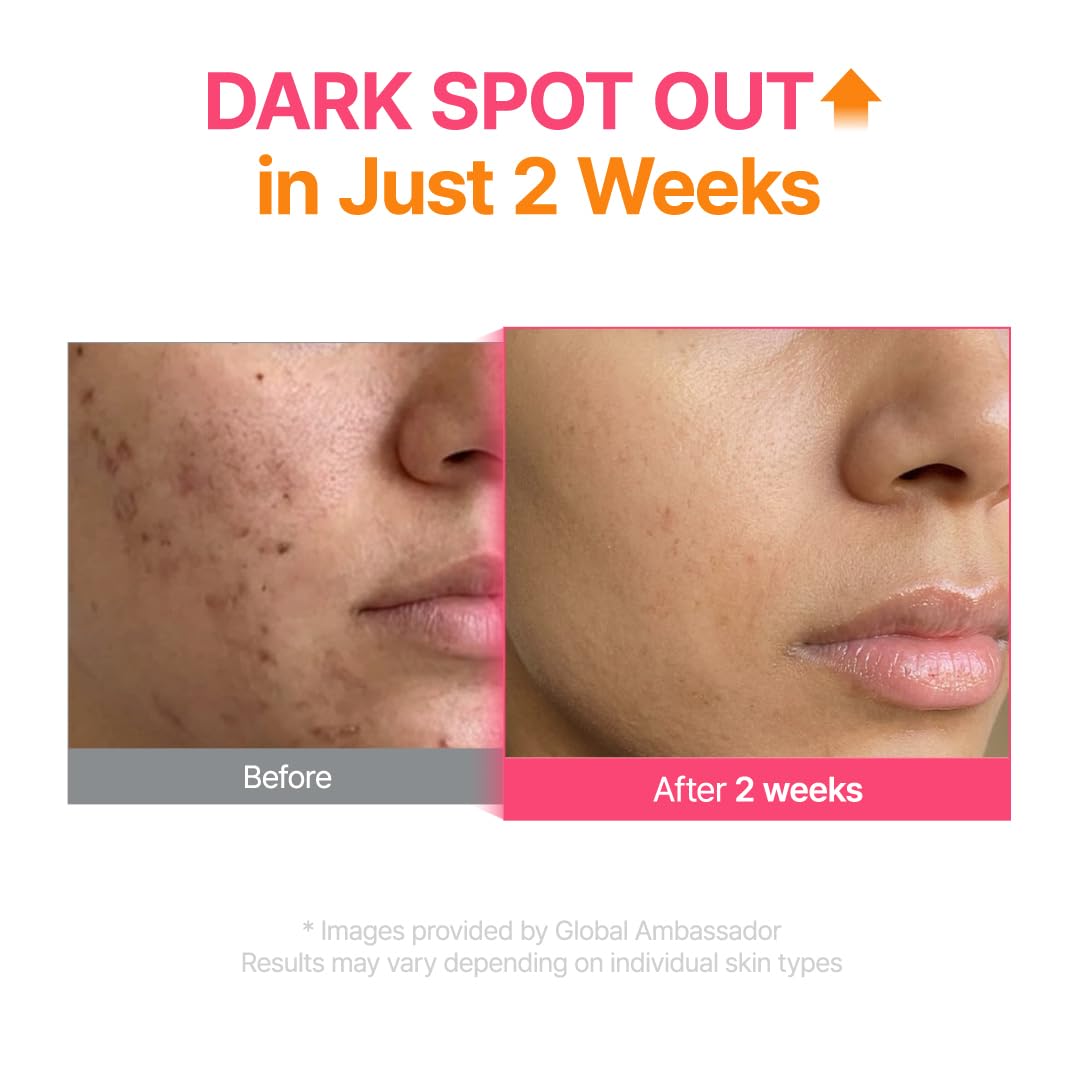 PURITO TXA 6% + Niacinamide Serum | Dark Spot Care, Korean Skincare