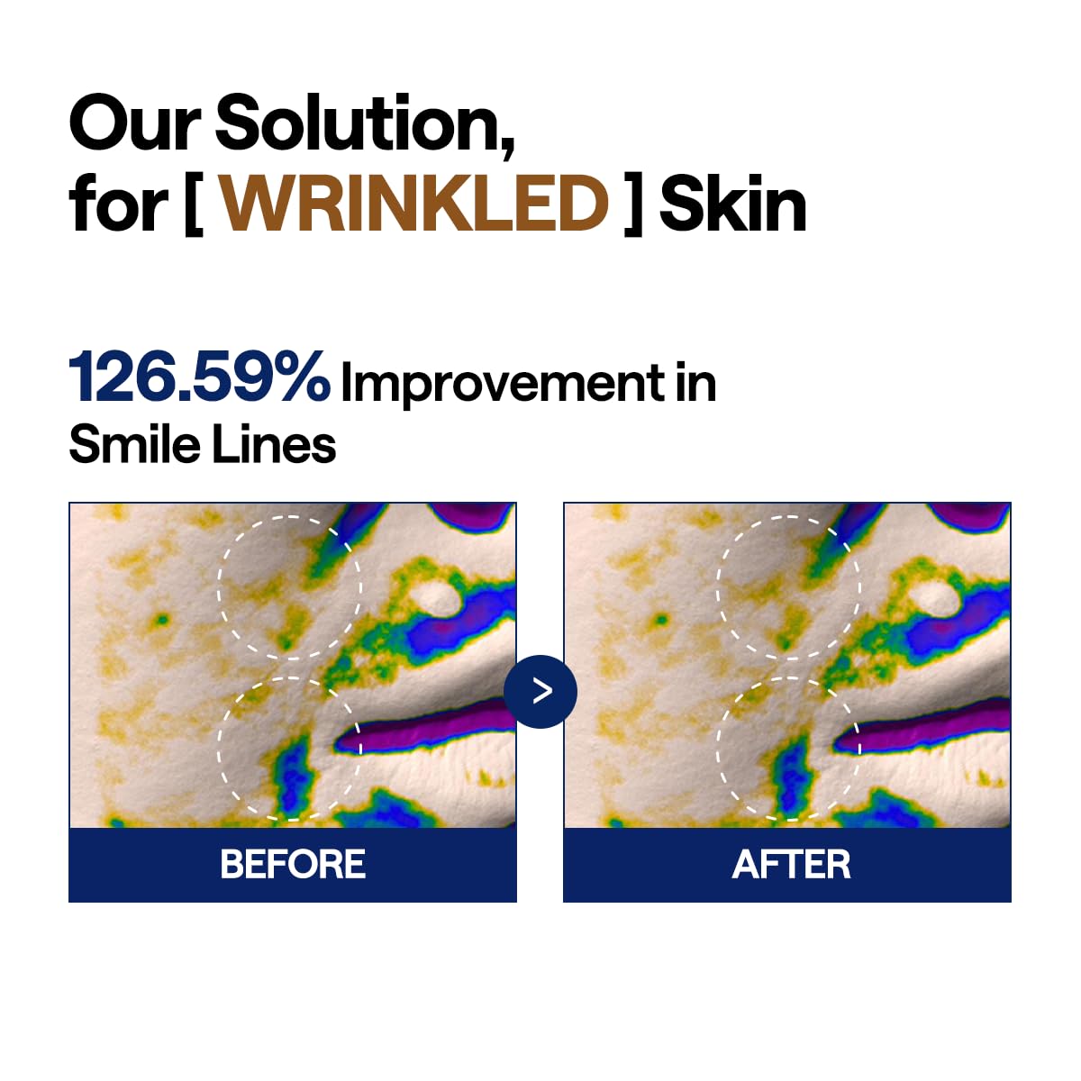 MEDIHEAL Toner Pads - Retinol Collagen Lifting Pad (100 counts) for Skin Rejuvenation & Firming