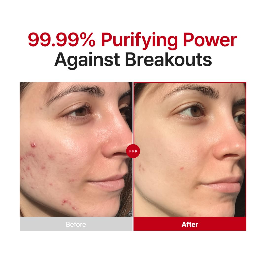 PURITO Hypochlorous Facial Spray | Mist Toner for Redness-Prone Skin Types