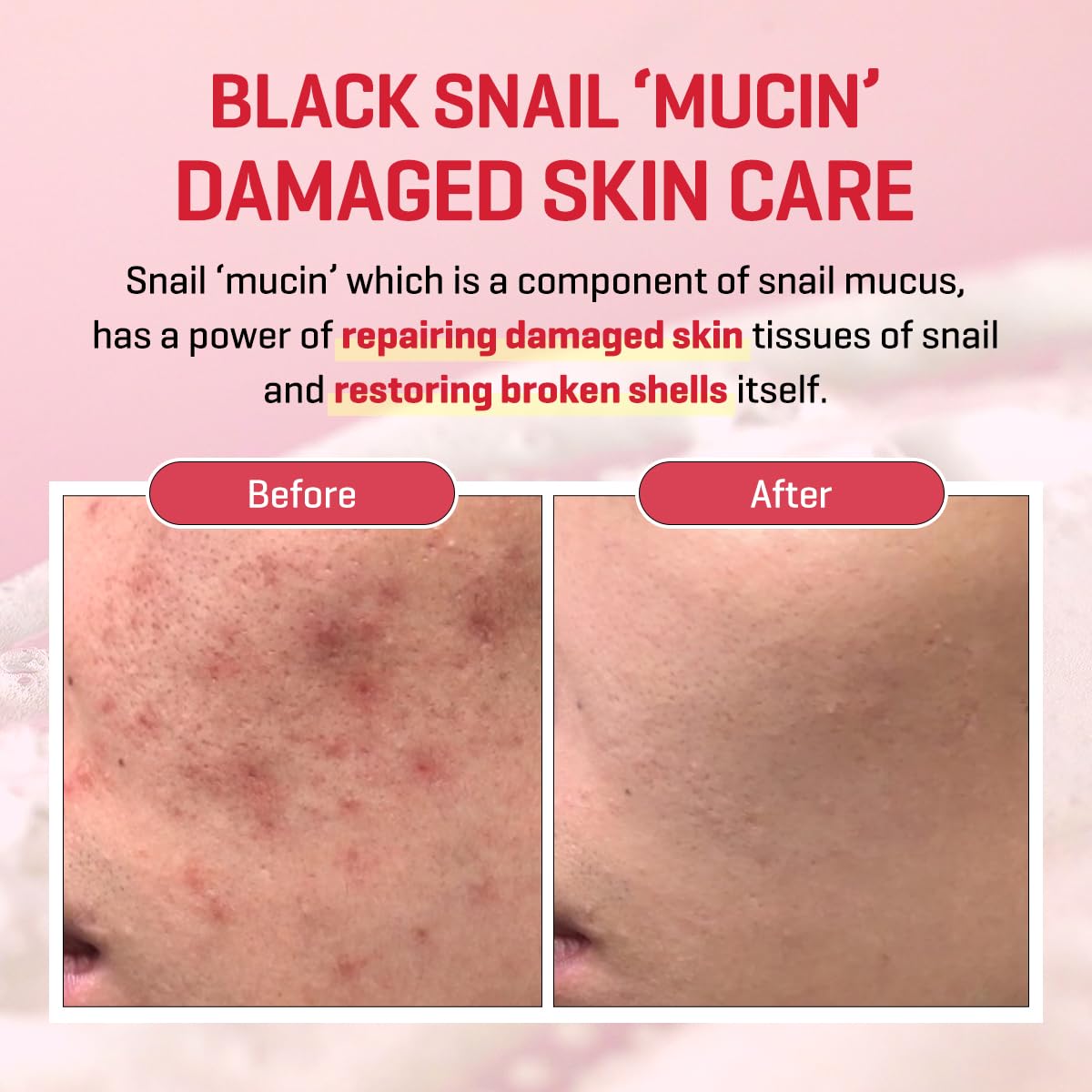 SOME BY MI Snail Trucica Miracle Repair Serum - 1.69Oz, 50ml - Made from Snail Mucin for Sensitive