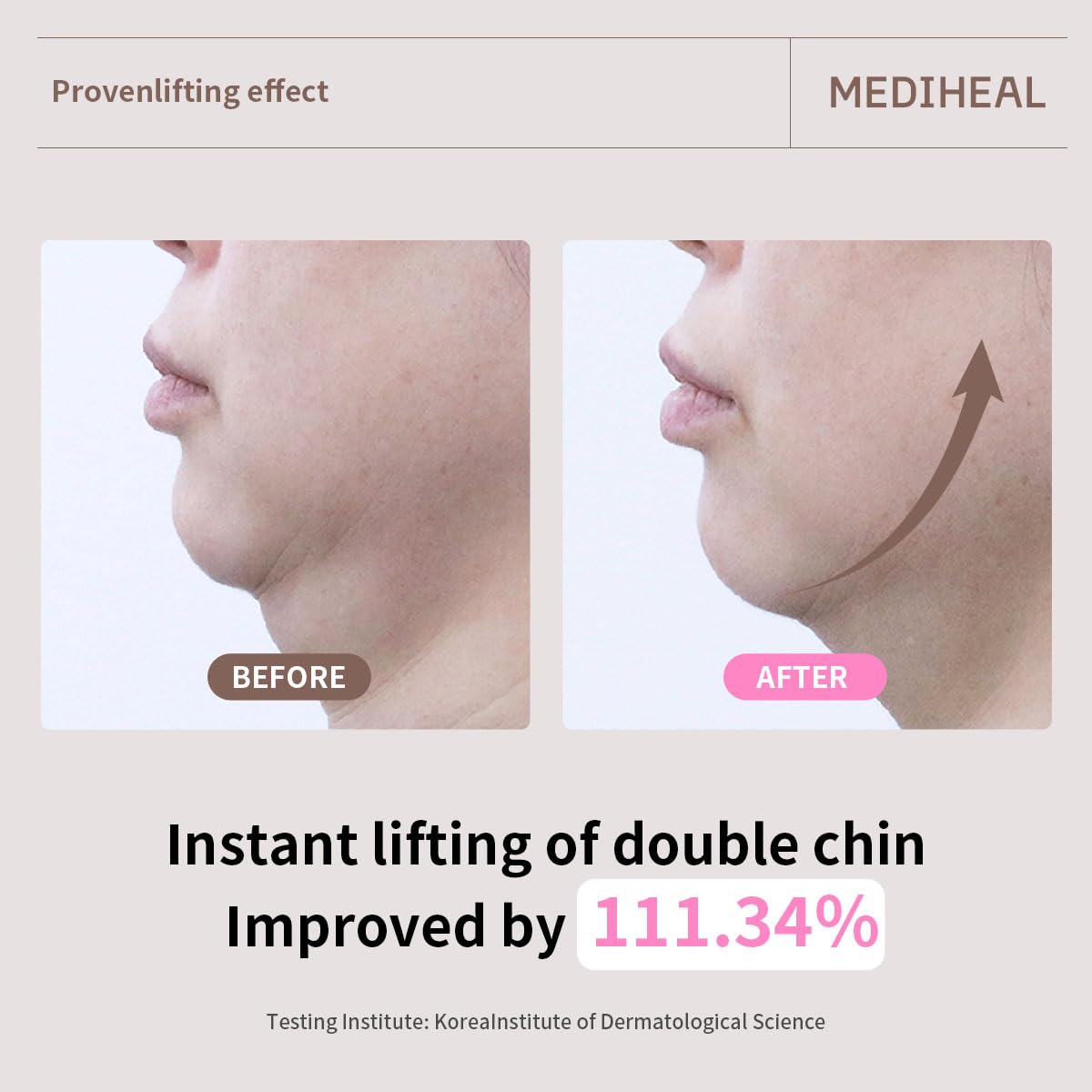 MEDIHEAL Retinol Collagen Ampoule Lifting Mask (10 Counts)
