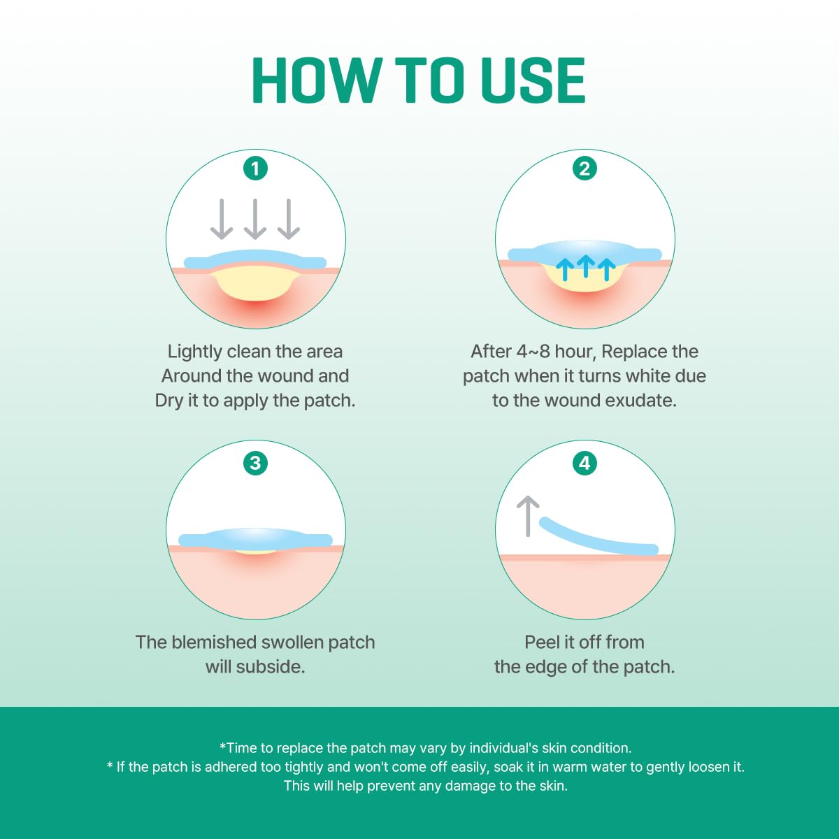 SOME BY MI 30 Days Miracle Clear Spot Patch - Pack of 5, 90 Counts, 2 Size(10mm 45Counts, 12mm
