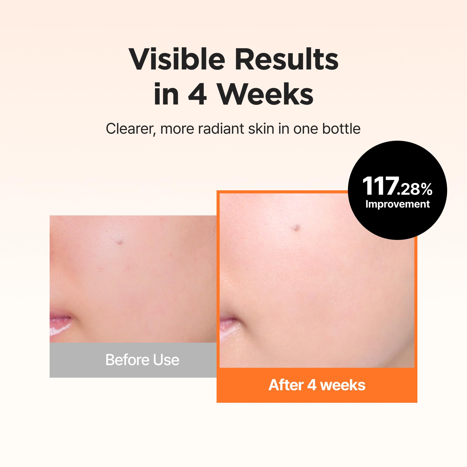 IsNtree Hyper Vitamin C 23 Serum | 23% Pure Vitamin C + Vitamin E & Panthenol for Face beauty I