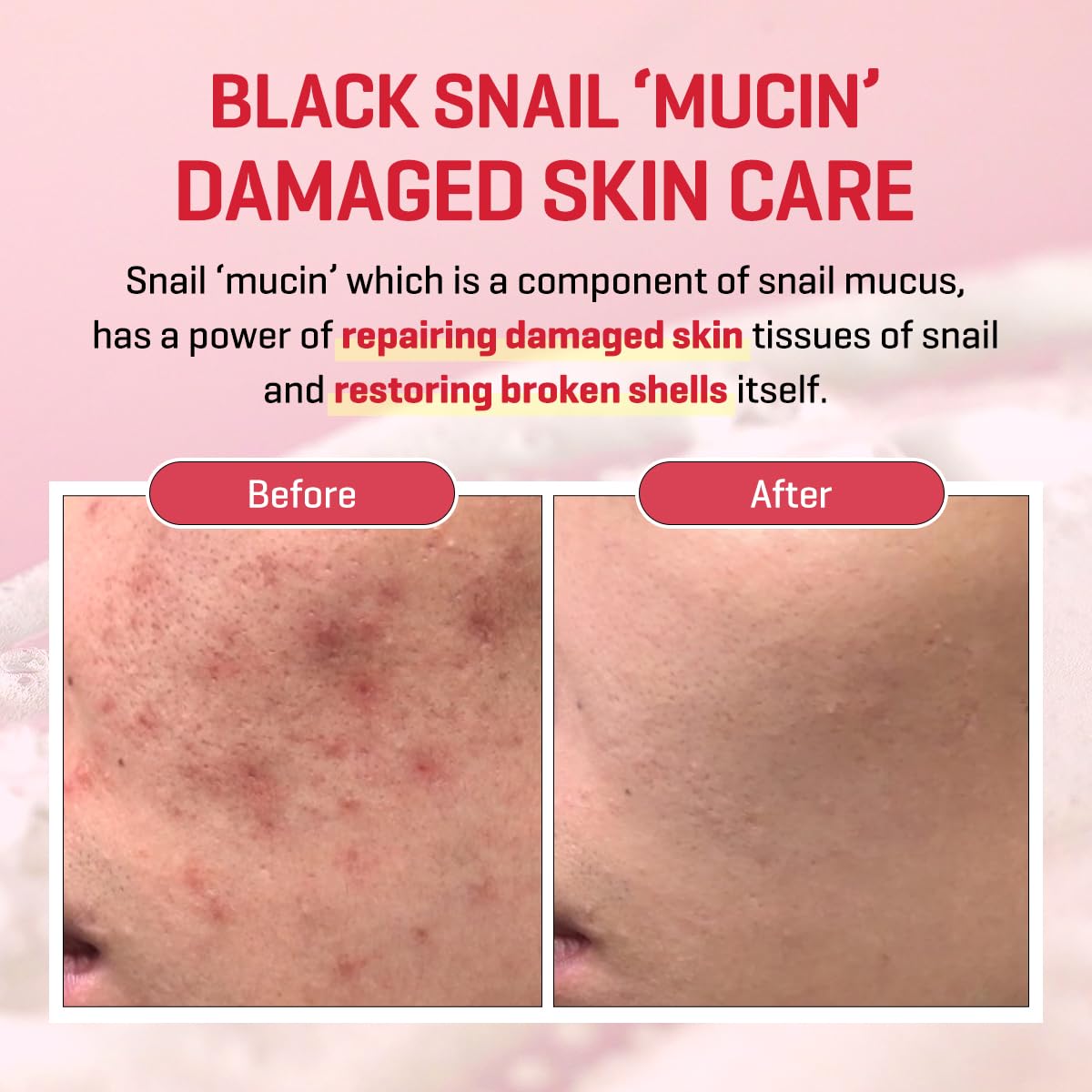 SOME BY MI Snail Truecica Miracle Repair Low pH Gel Cleanser - 3.38Oz, 100ml - Made from Snail