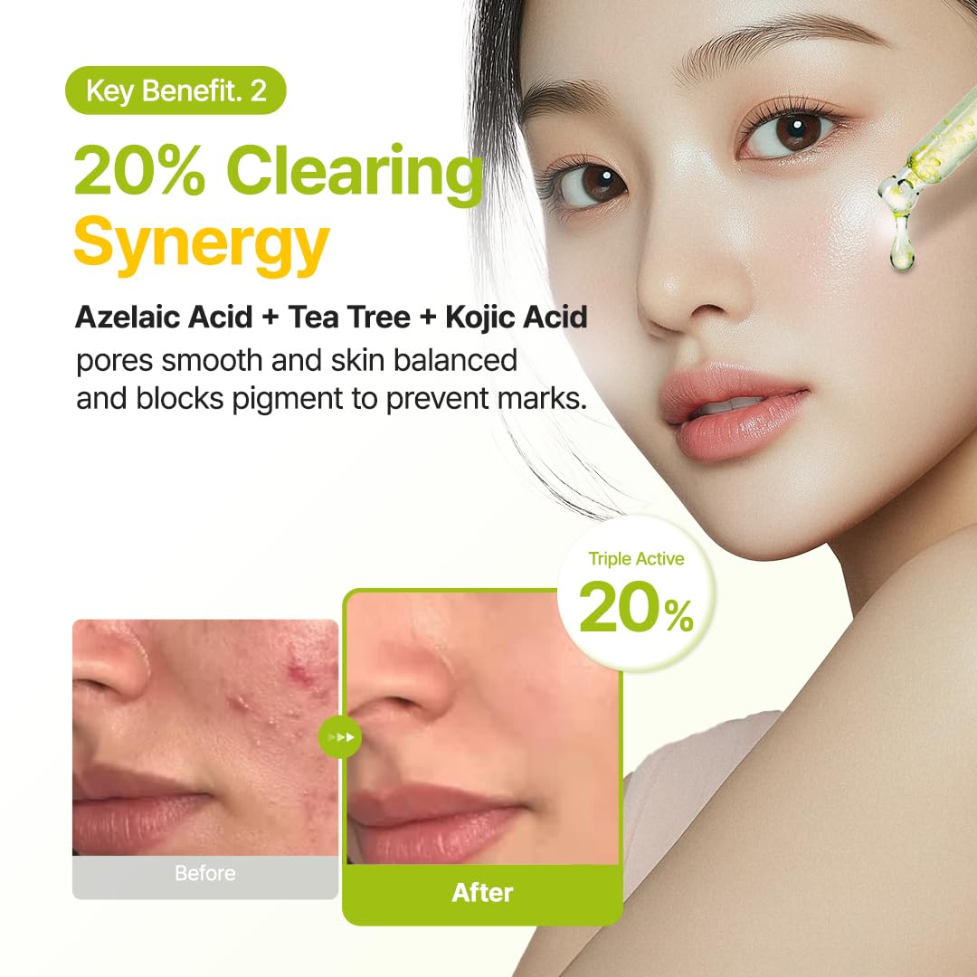 PURITO Azelaic 10% + Kojic Serum | Blemish Care, Redness Relief 1.01 Fl.oz
