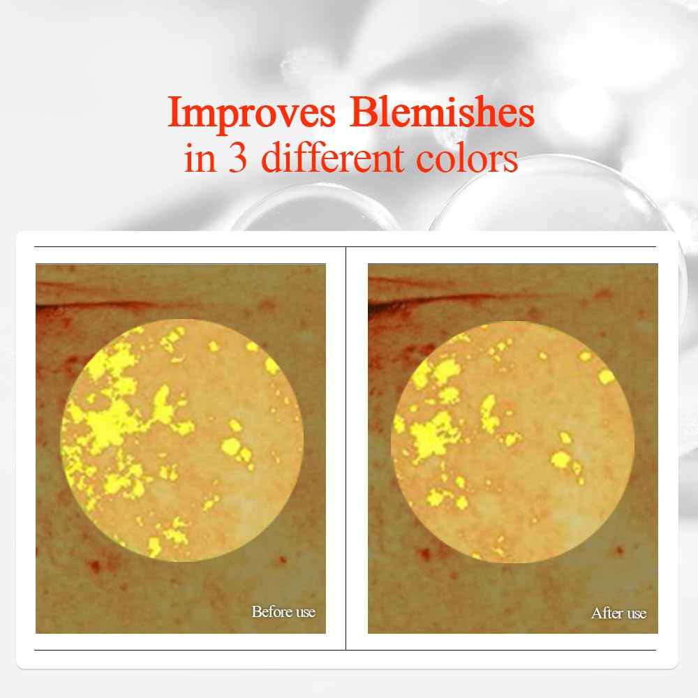 Pyunkang Yul PKY Radiance Vita Serum, 1 Fluid Ounce – Hydrating Serum for Dry Skin with Hyaluronic Acid, Niacinamide, Panthenol, Pearl Extract, 24-Hour Moisturizing and Elasticity Care, EWG Green