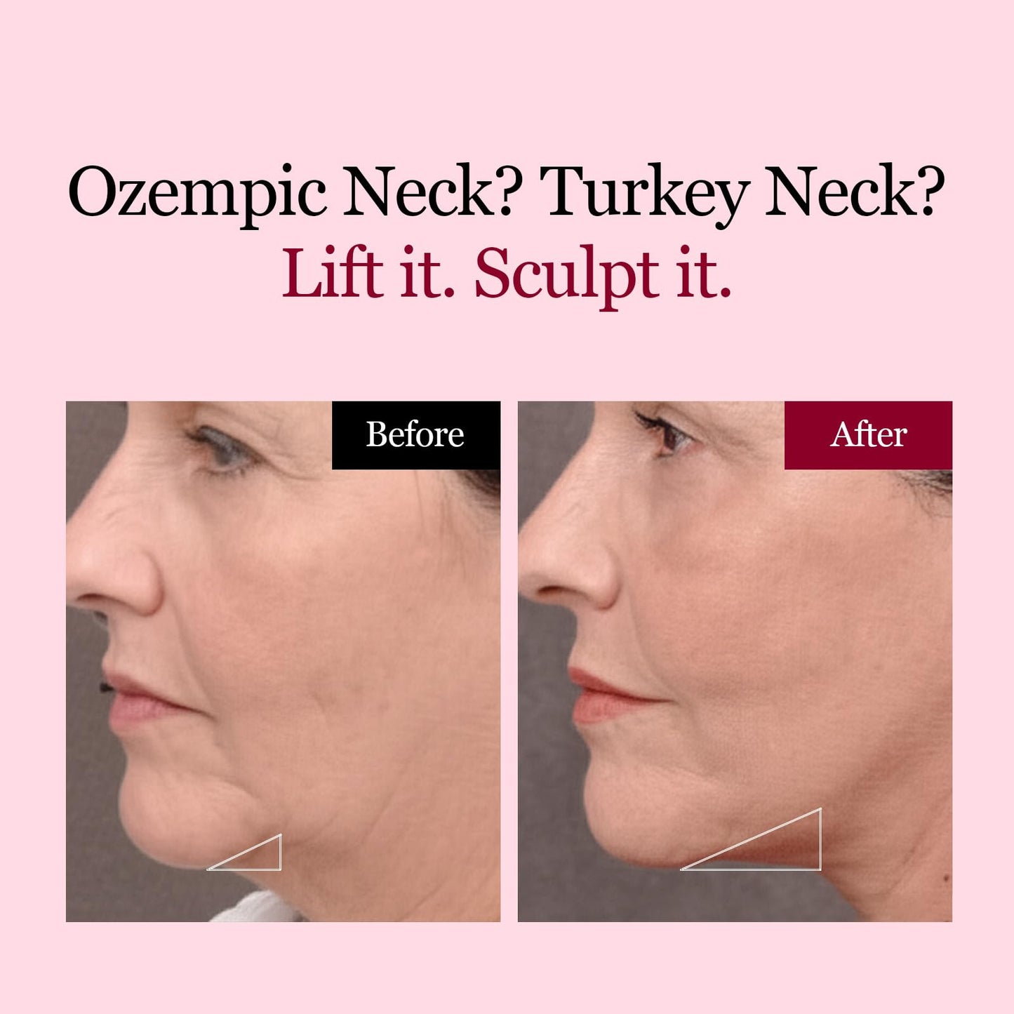 ROUND LAB Camellia Deep Collagen V Lifting Gel Mask 4ea | Double-chin Turkey Neck Instant Face
