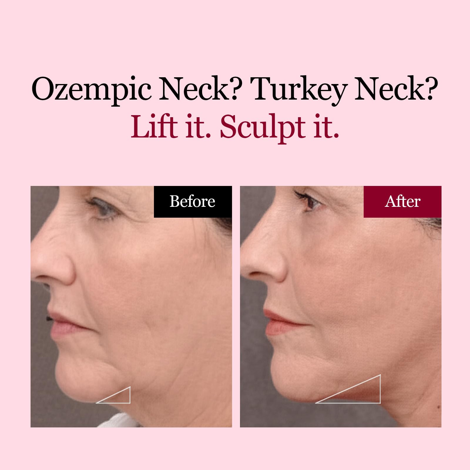 ROUND LAB Camellia Deep Collagen V Lifting Gel Mask 4ea | Double-chin Turkey Neck Instant Face