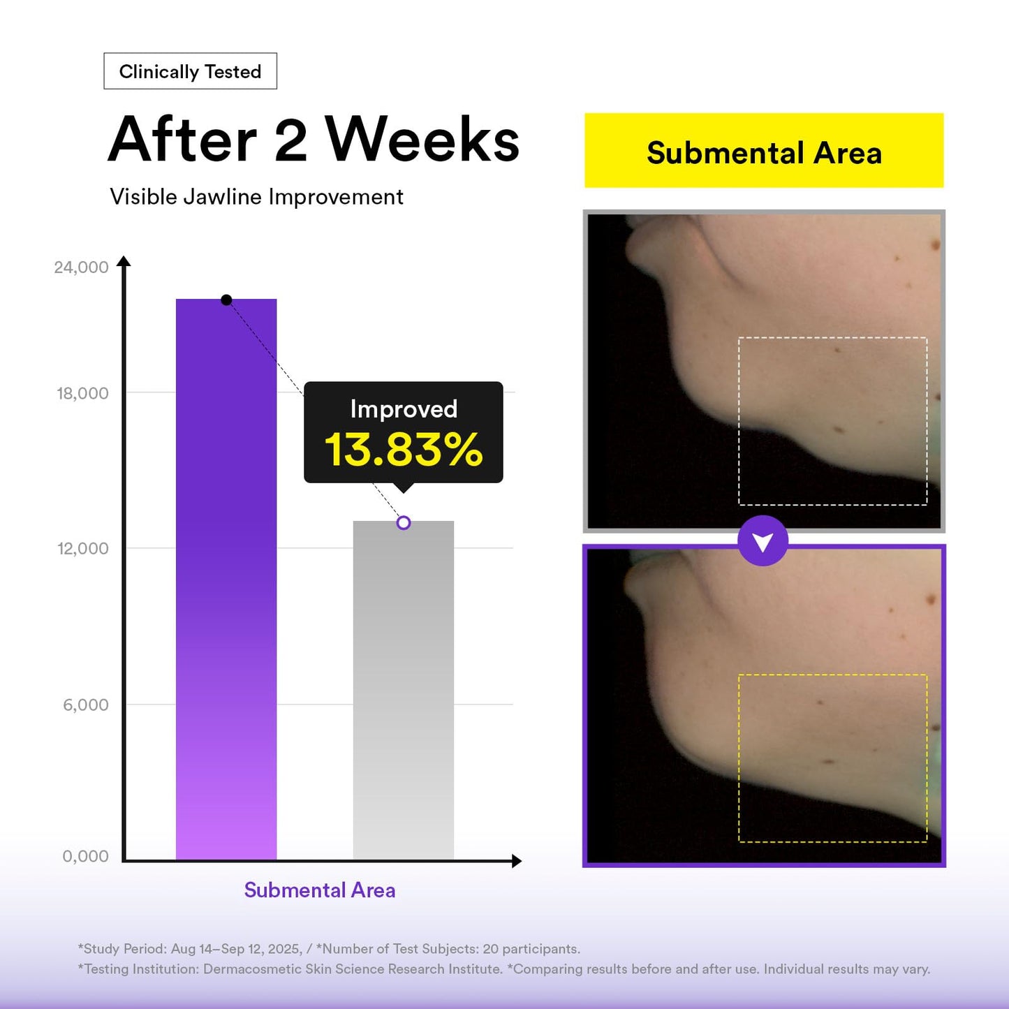 Abib Silhouette Lifting Cream Mask V-up Solution (4 sheets) with PLGA-Peptide, Jawline Double Chin