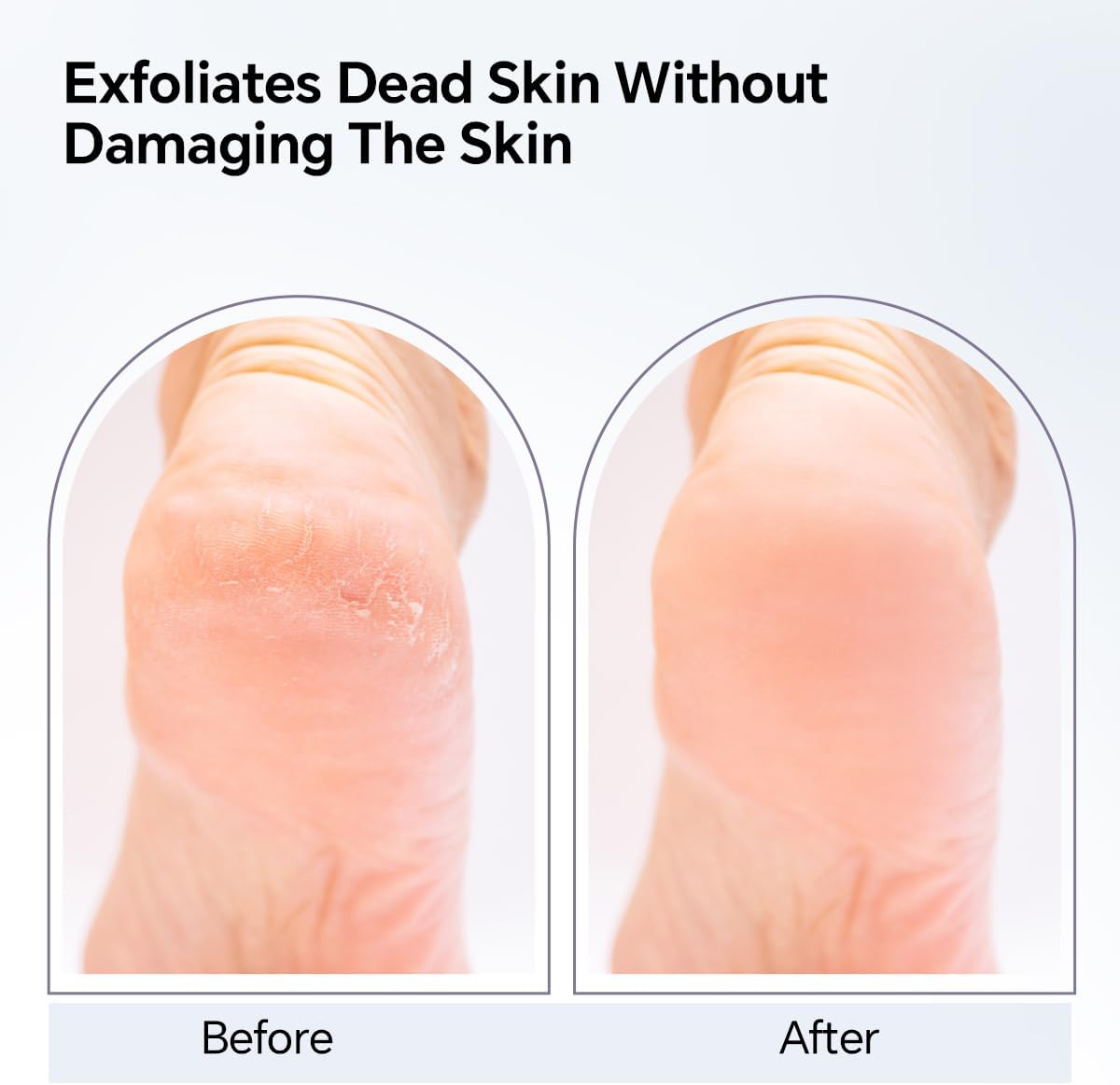 Nano Glass Foot File, Foot Callus Remover, Double Sided Pedicure Tools for Feet, Dual Use of Dry and Wet, Professional Hygienic Foot Scrubber to Achieve Smooth, Silky Feet Instantly (Gray)