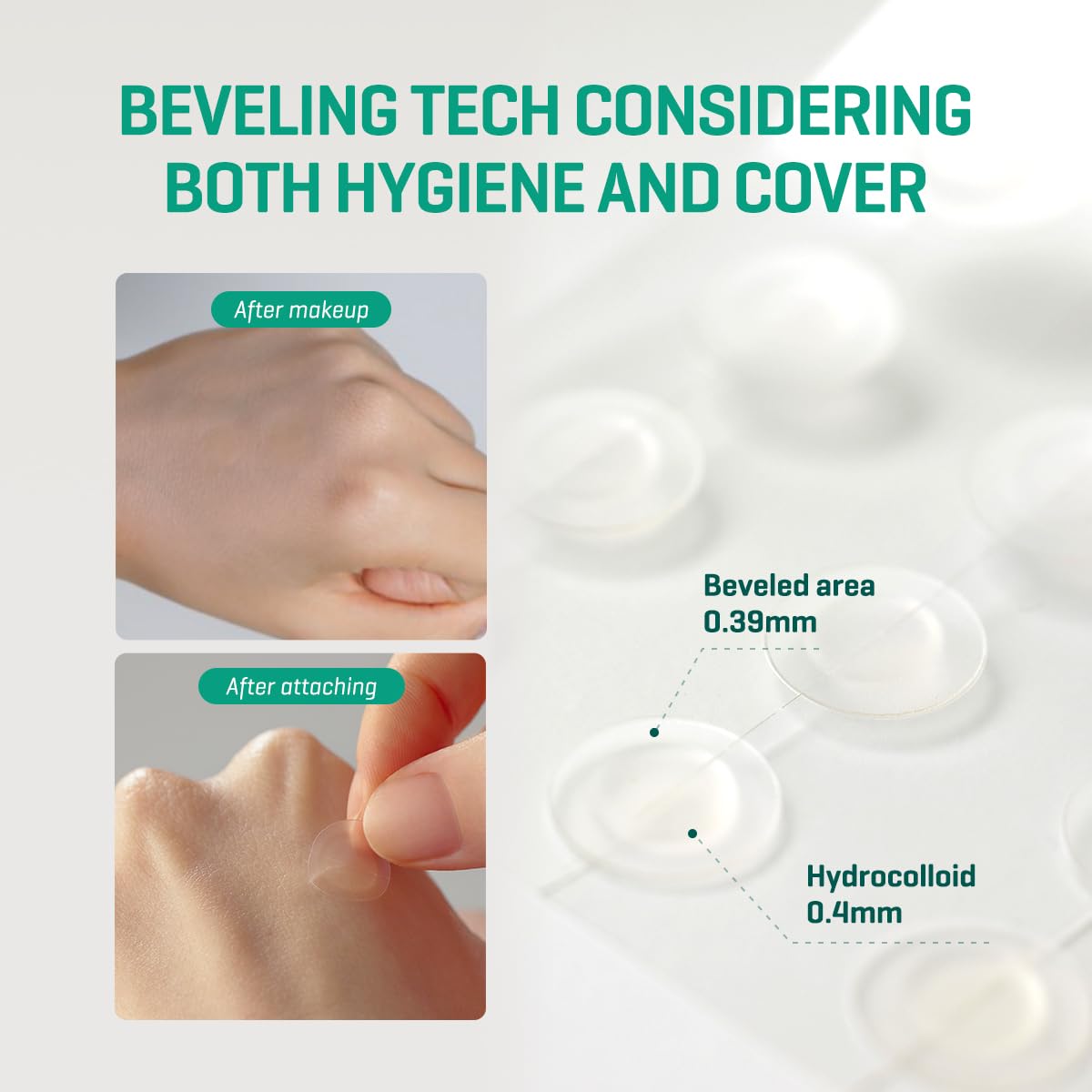 SOME BY MI 30 Days Miracle Clear Spot Patch - Pack of 5, 90 Counts, 2 Size(10mm 45Counts, 12mm