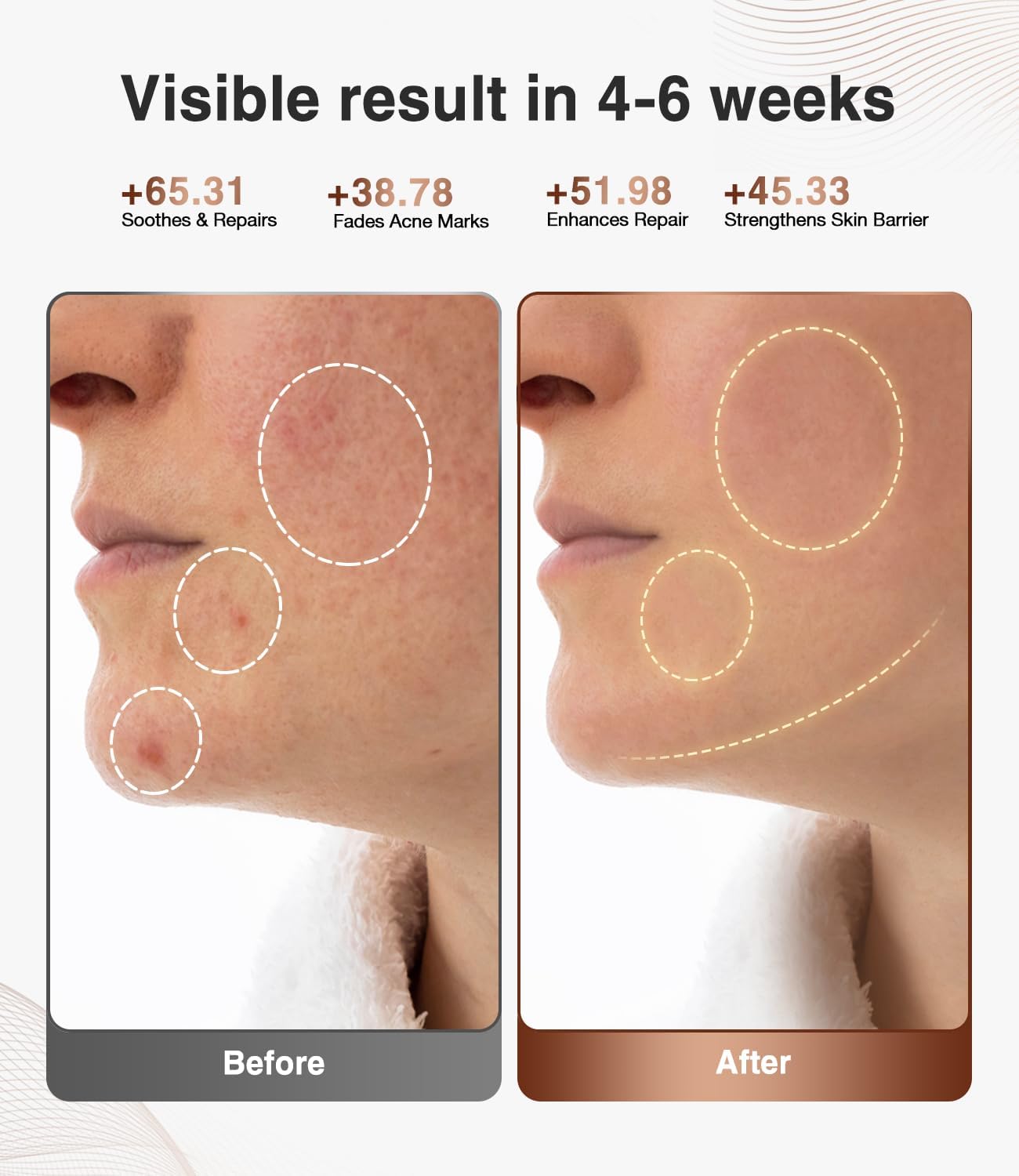 JOVS Red Light Therapy Mask for Face, LED Face Mask with Near-Infrared Light, Rechargeable, 4 Modes, Portable Anti-Aging Skin Care Device for Home Use