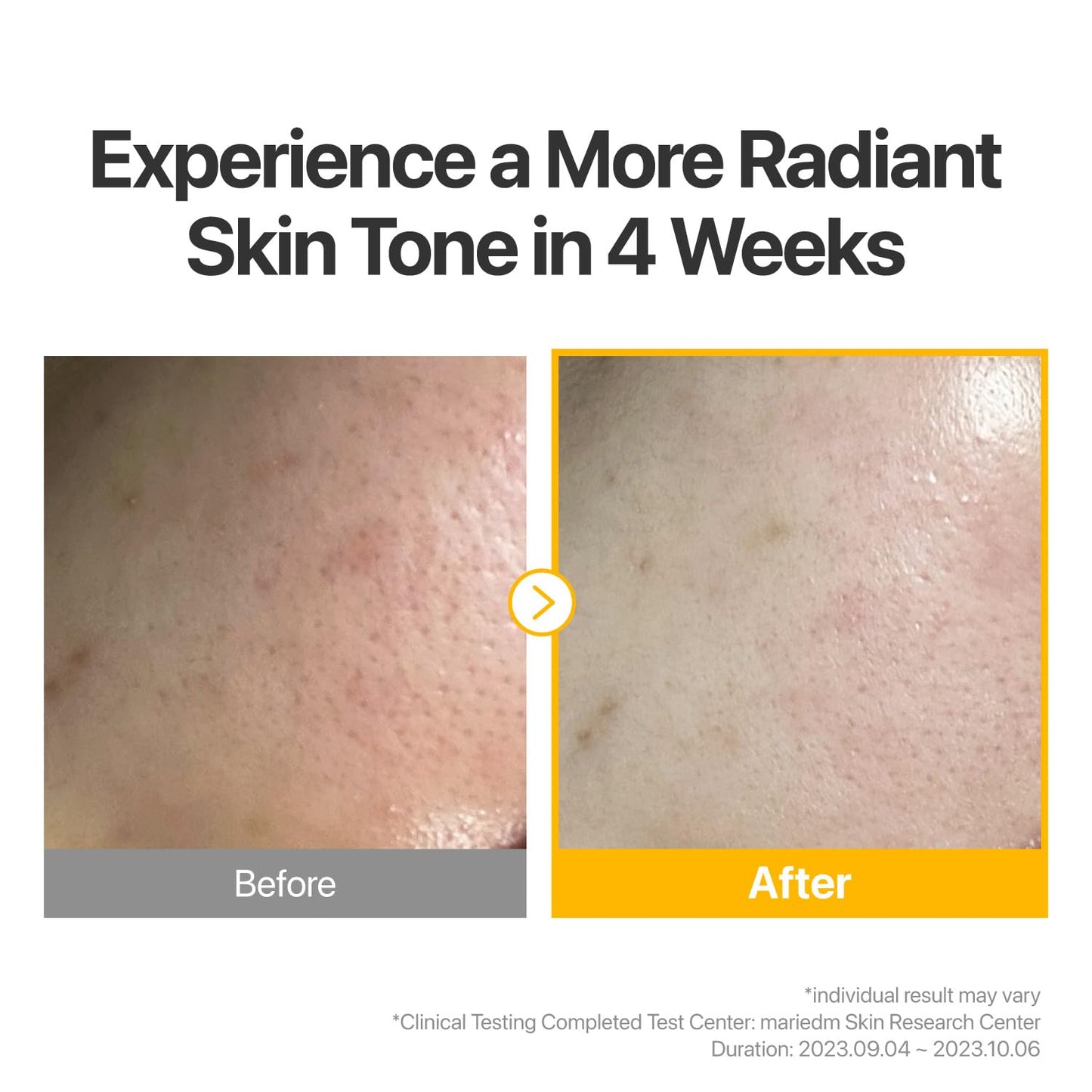 numbuzin No.5 Sheet Mask | Vitamin Spotlight Sheet Mask | Glutathione and Vitamin C | Reduces