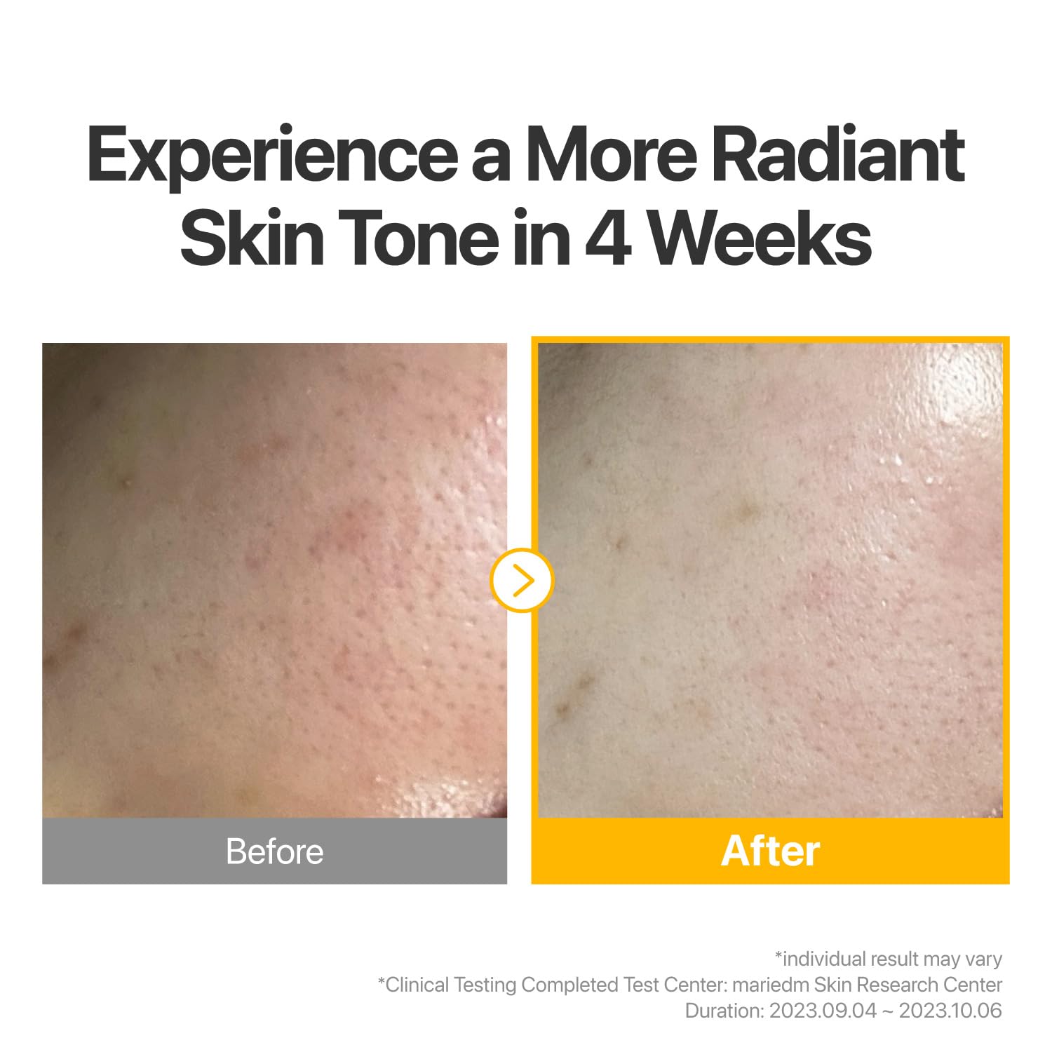 numbuzin No.5 Sheet Mask | Vitamin Spotlight Sheet Mask | Glutathione and Vitamin C | Reduces