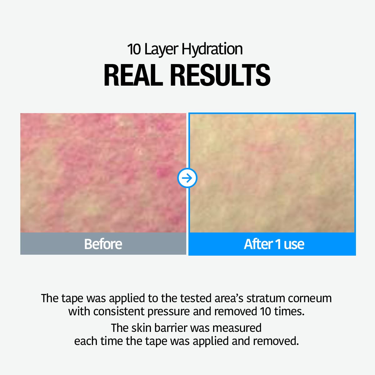 GOODAL Heartleaf Hyaluron Soothing Toner - Trouble Care, Soothing, Moisturizing, Hydrating, Calming