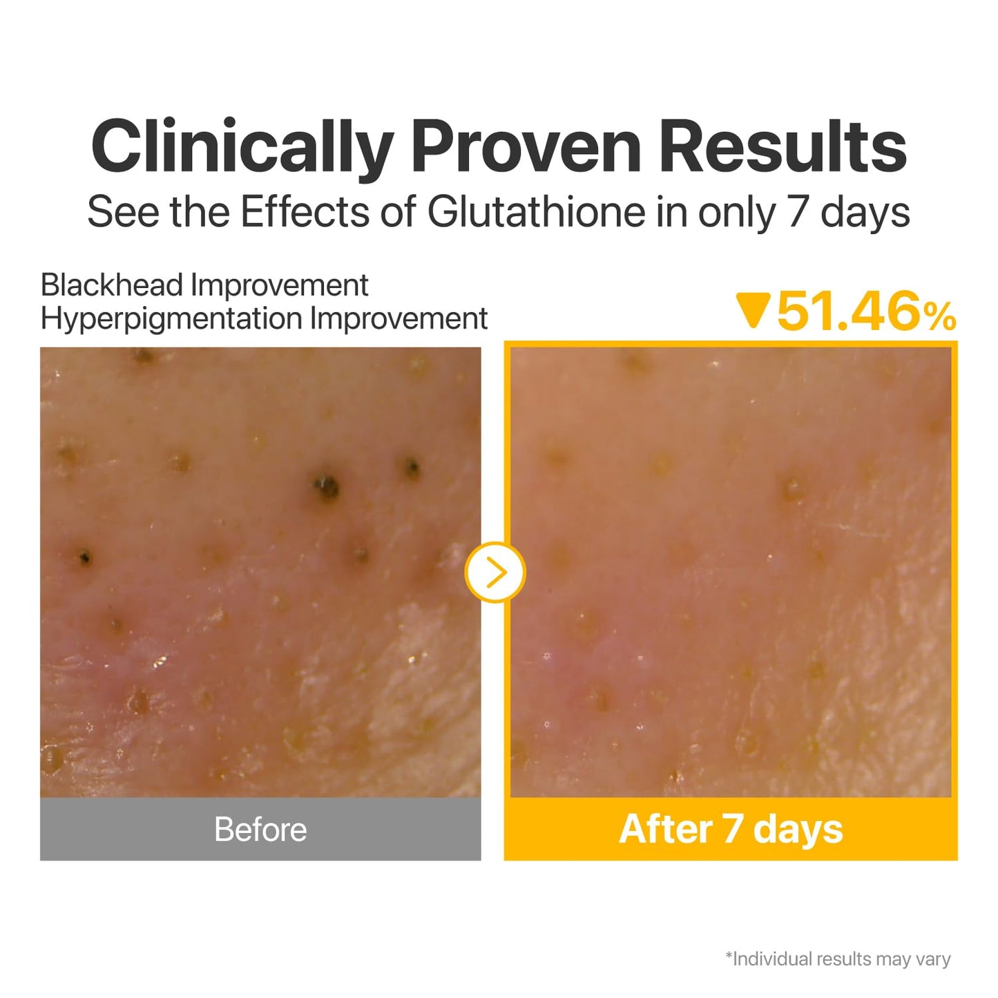 numbuzin No.5 Cleansing Oil, Glutathione & Vitamin C Cleanser for Pores, Sebum & Dark Spots, Rich