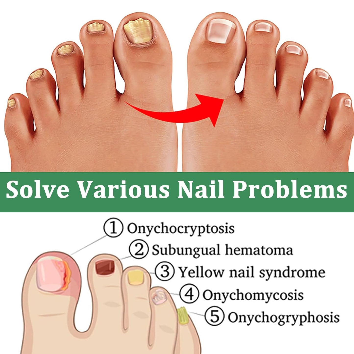 Nutraboost Nail Treatment Gel, Nail Growth Serum for Repair & Strengthener, Multi-Purpose Nail Repair Serum (1)