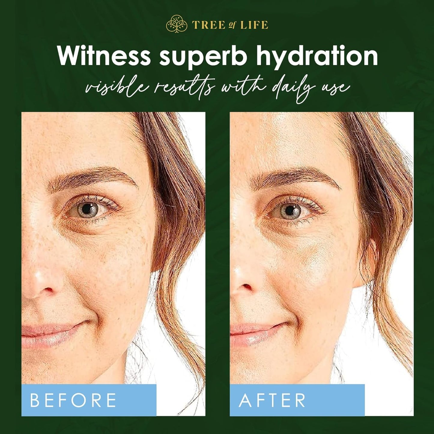 Tree of Life Beauty Hyaluronic Acid Serum, Skin Brightening Face Oil for Dark and Age Spots, Facial Serums for Dry and Sensitive Skin Care with Vitamin E for Soft Smooth Skin, 2 Fl Oz