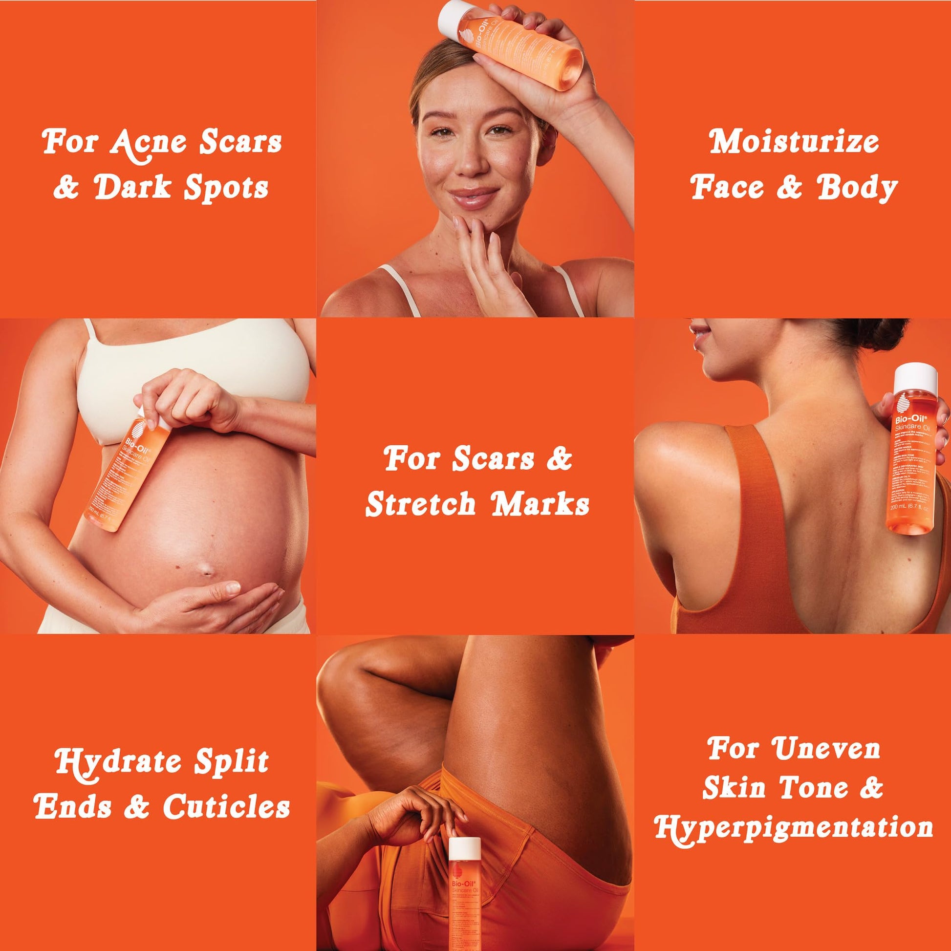 Bio-Oil Skincare Body Oil Serum, Scars & Stretch Marks, 2 fl oz