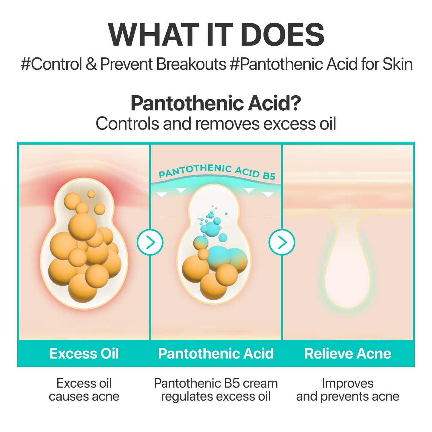 numbuzin No.1 Pantothenic B5 Active Soothing Cream | Remove sebum and skin troubles, Pantothenic