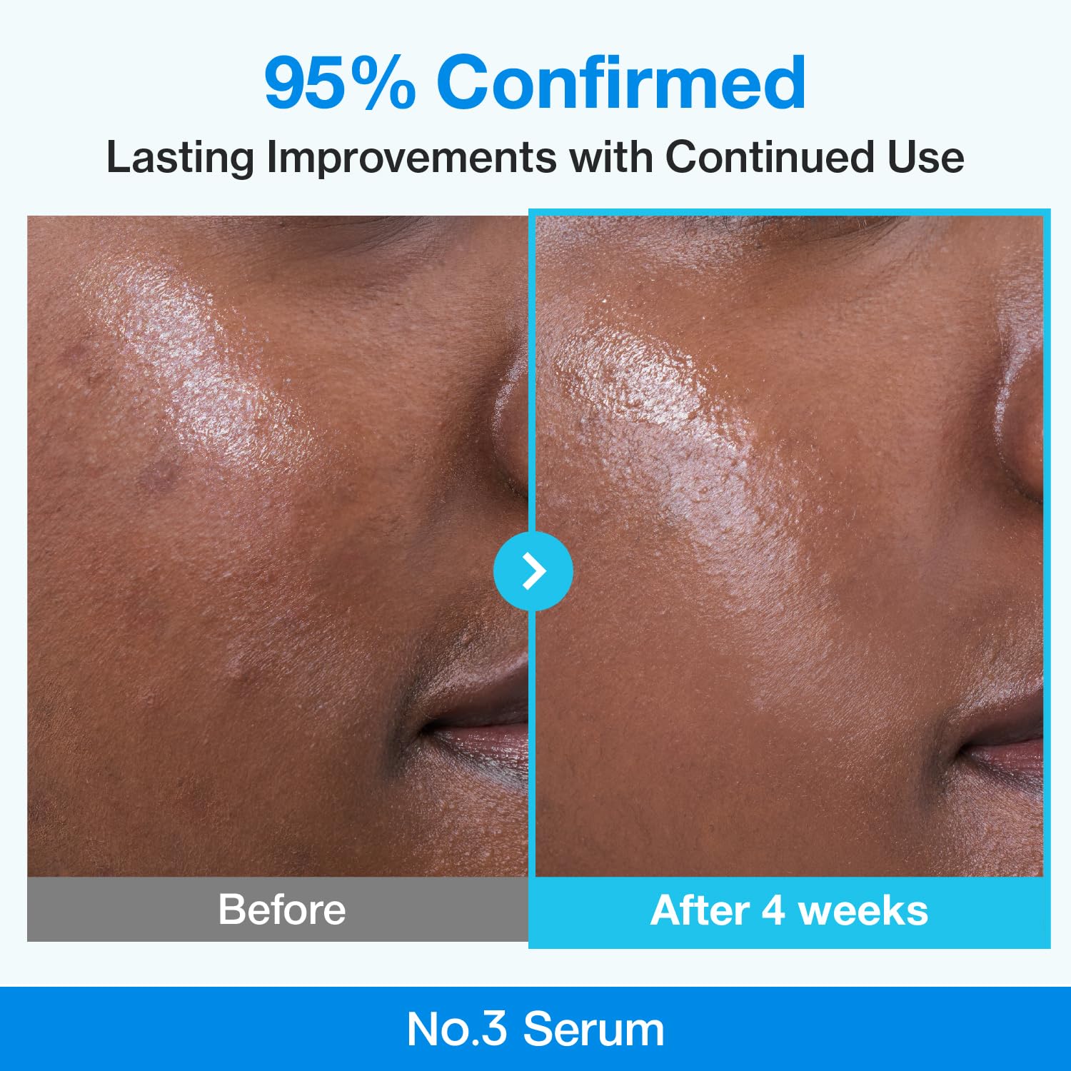 numbuzin No.3 retinol Serum | Blue Bio-Retinol Pore Refining Serum | Retinol Beginner, Tightening