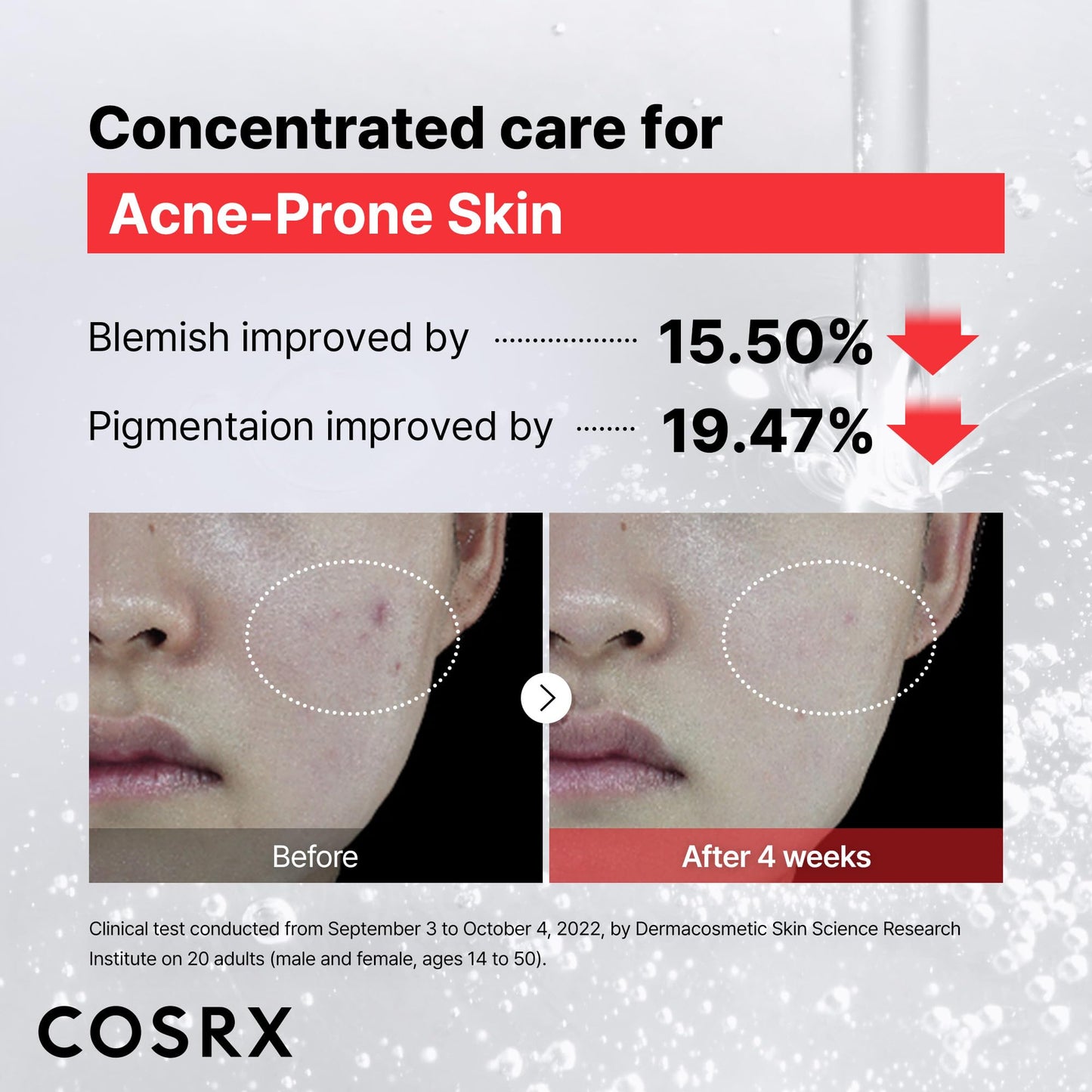 COSRX 15% Niacinamide Face Serum, 0.67 fl oz, Pore Minimizer Serum for Face, Even Skin Tone, Korean