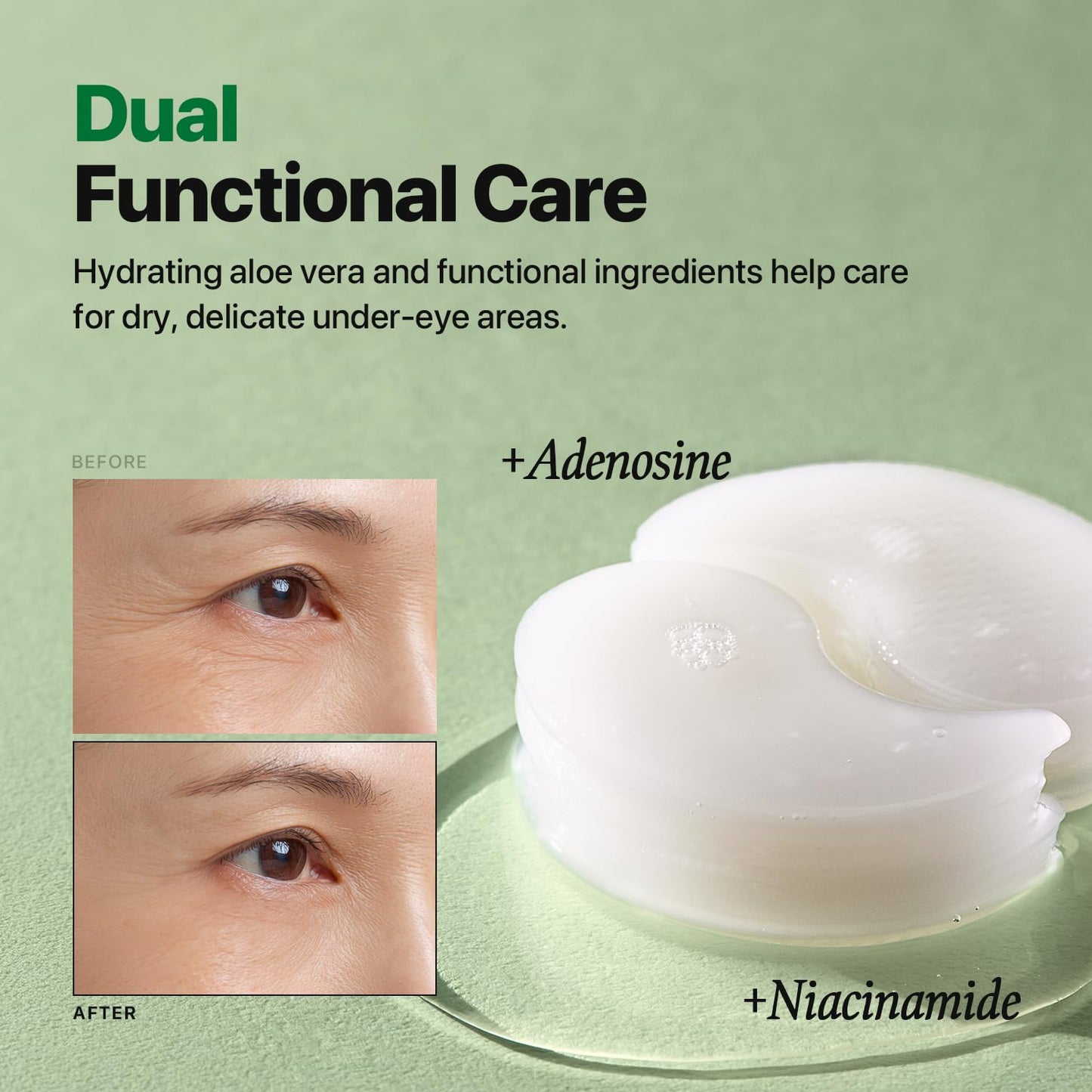 Nature Republic Real Squeeze Aloe Vera Eye Patch | Under Eye Masks for Dark Circles & Puffy Eyes