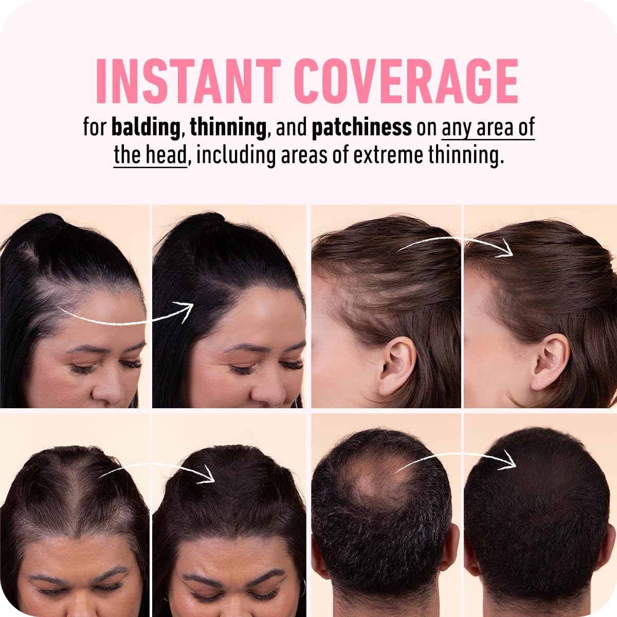 BOLDIFY Hairline Powder (LARGE, 10g) - Root Touch Up Hair Color for Gray Coverage - Bald Spot Concealing Hair Powder for Women & Men - 48-Hour Stain-Proof - Auburn