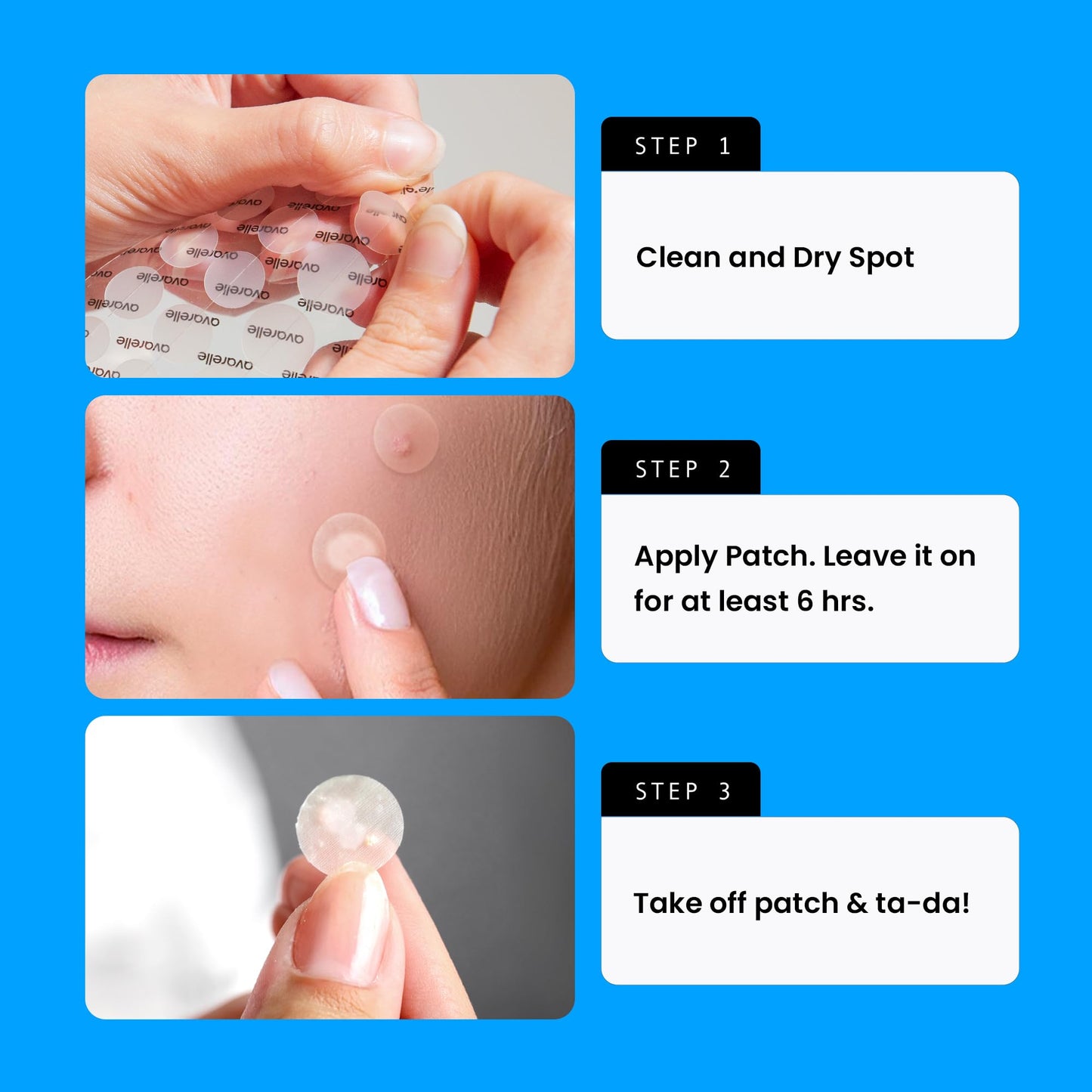 AVARELLE Original Hydrocolloid Acne Patches Korean Skincare 300 Count Bulk