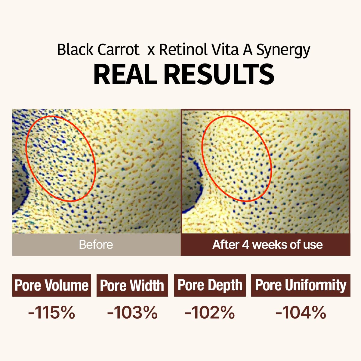 GOODAL Black Carrot VITA-A Retinol Ampoule 30ml, Hydration Facial Serum for Glowy Skin, Lightweight