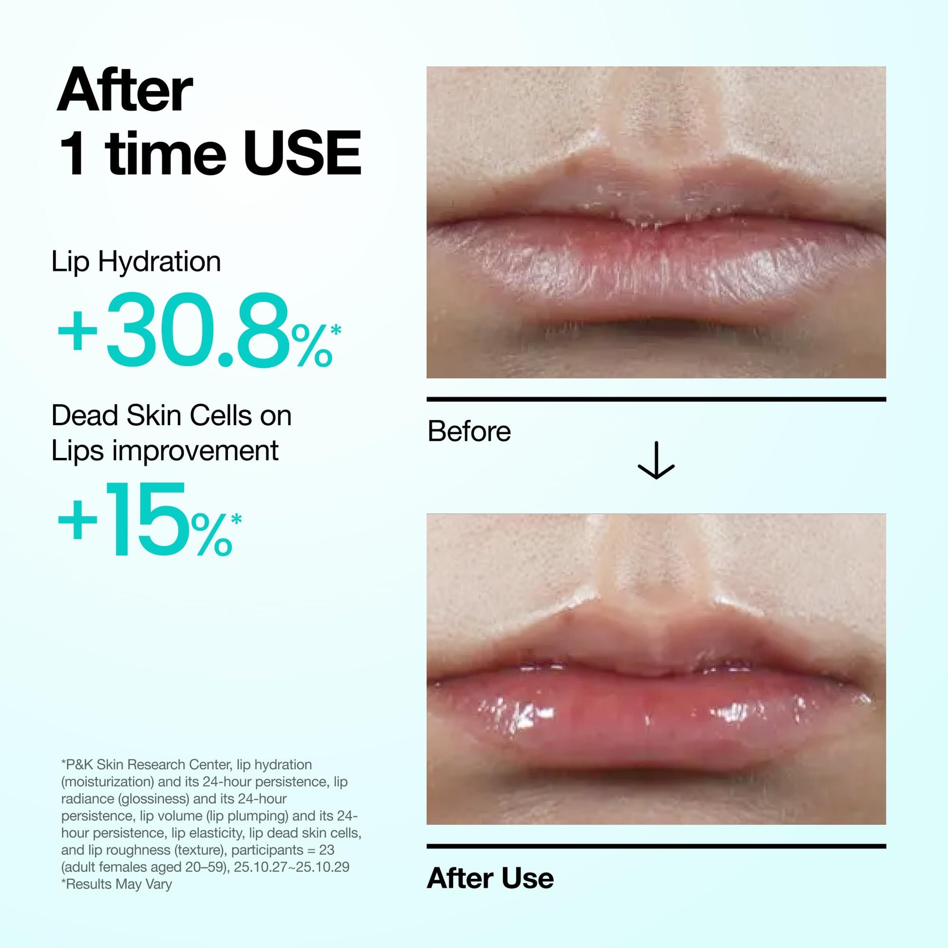 Anua PDRN Lip Serum, 0.33 fl.oz
