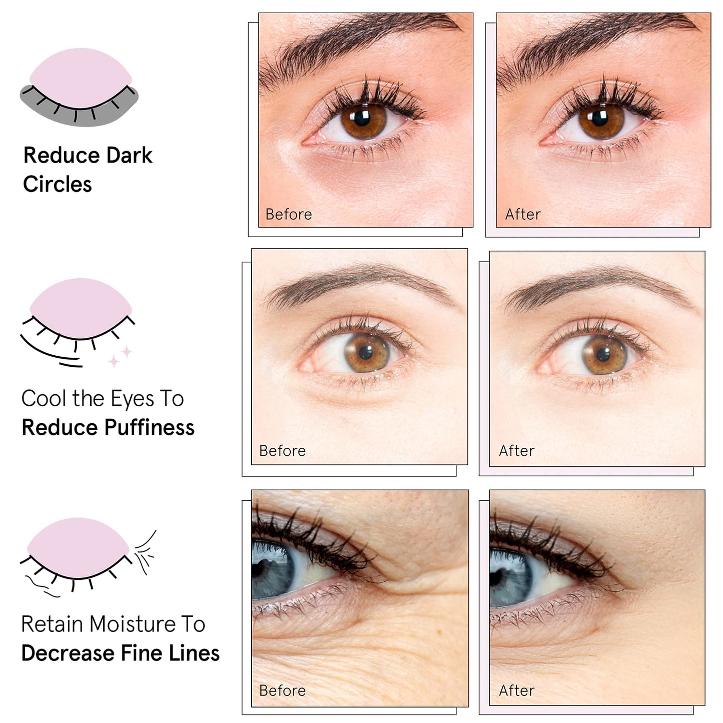 grace & stella Award Winning Under Eye Mask - Reduce Dark Circles, Puffy Eyes, Undereye Bags, Wrinkles - Gel Under Eye Patches - Gifts for Girlfriend - Vegan Cruelty-Free Self Care (48 Pairs, Pink)