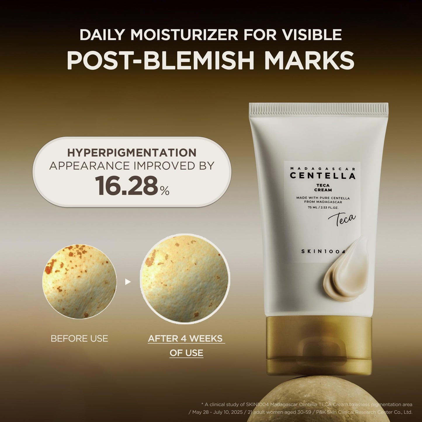 SKIN1004 Madagascar Centella TECA Cream, Face Moisturizer with 50X Centella TECA Technology for