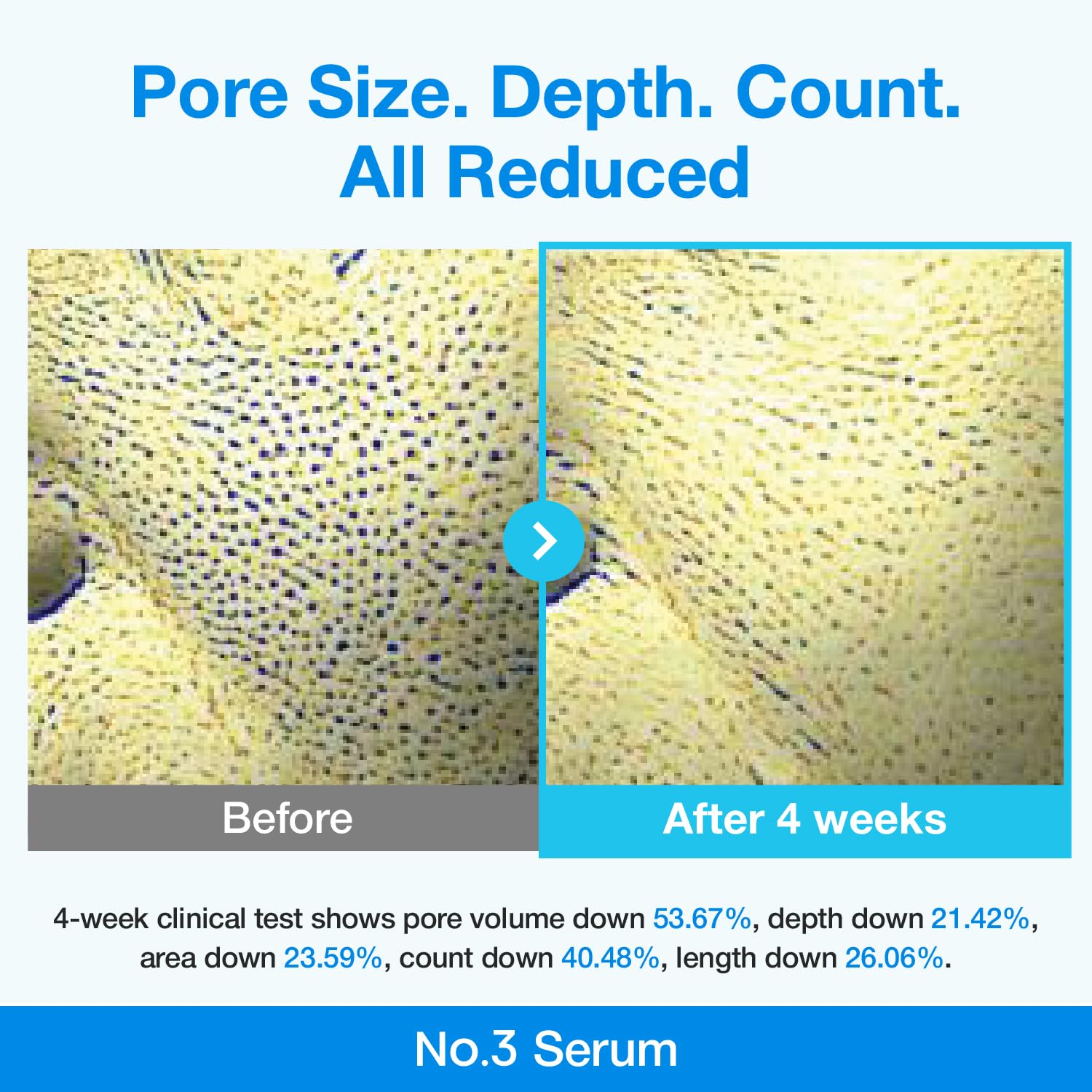 numbuzin No.3 retinol Serum | Blue Bio-Retinol Pore Refining Serum | Retinol Beginner, Tightening