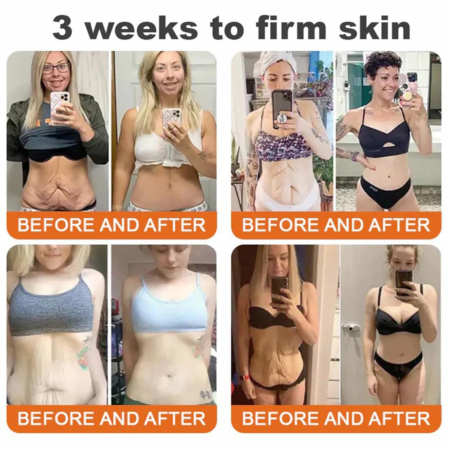 Bee Venom Comprehensive Cream, Professional bee venom cream for Removing and Repair, APKAPK Bee Venom Skin Treatment Cream, Natural Serum Suitable for All Skin Types (3 Pack)